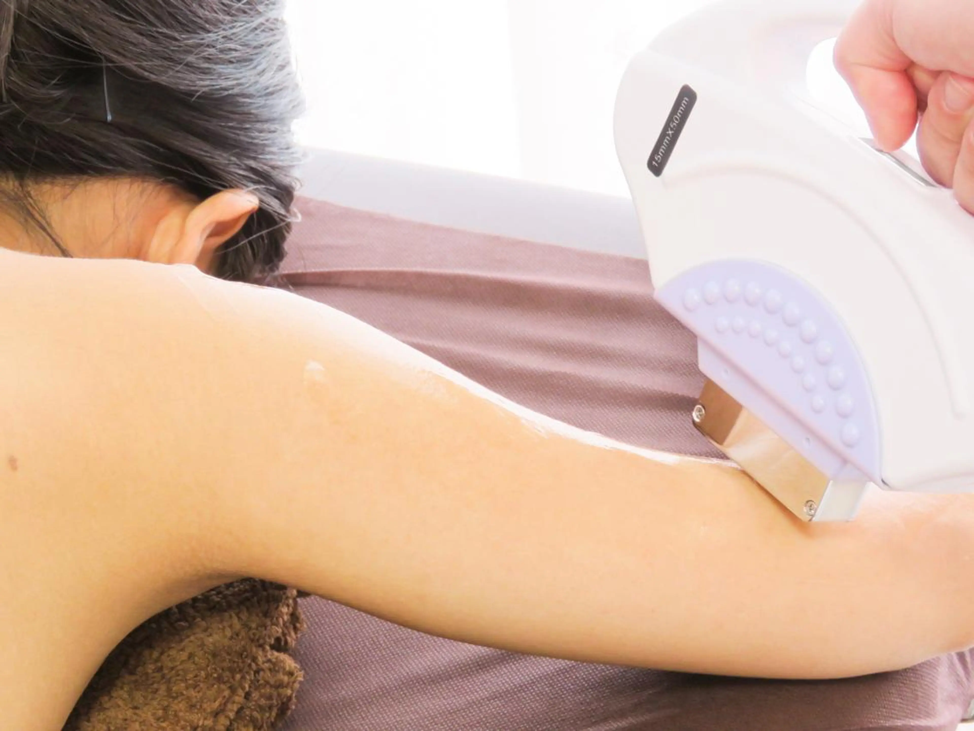 うで全体脱毛（指先込み）の写真