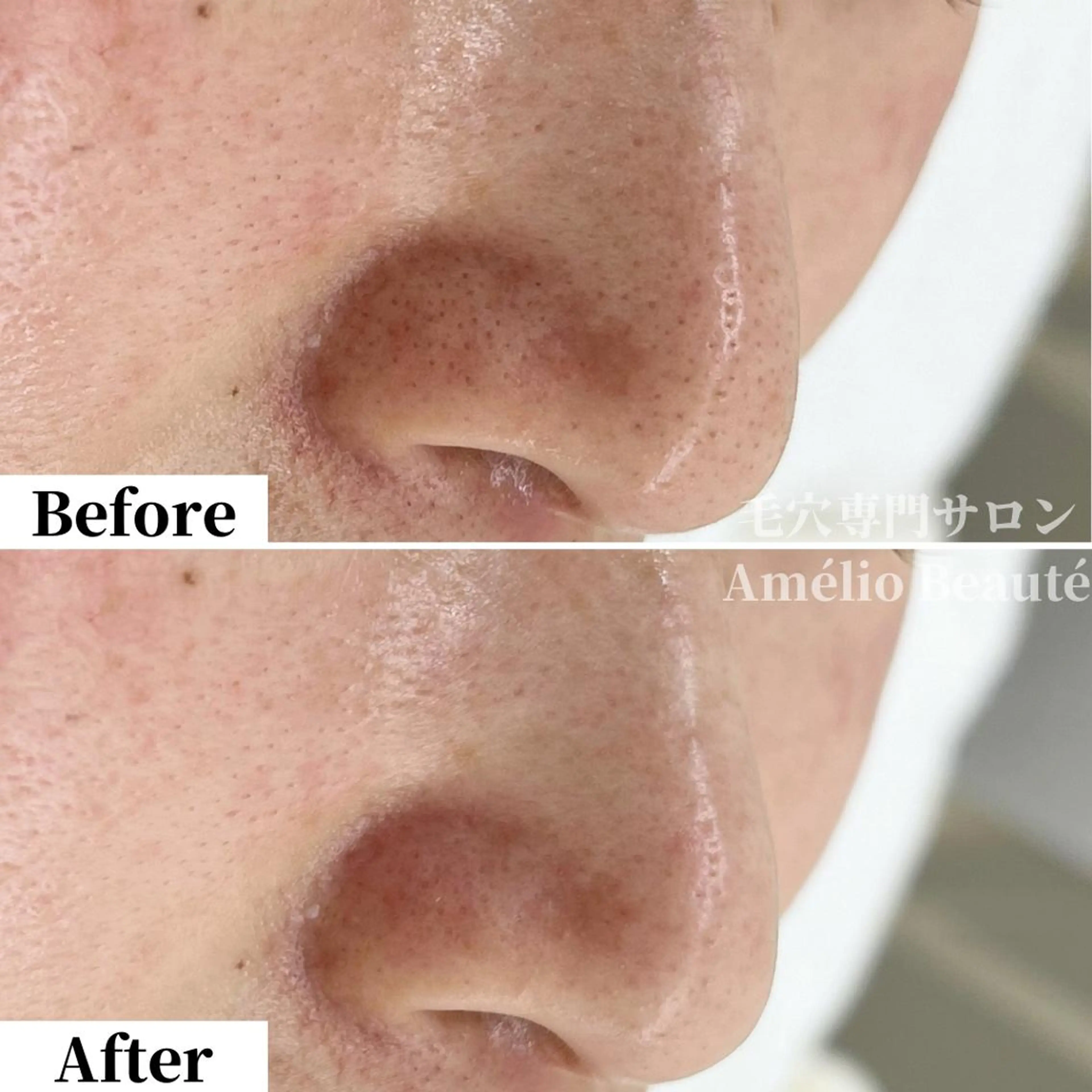 毛穴ケア専門サロン アメリオボーテのその他イメージ