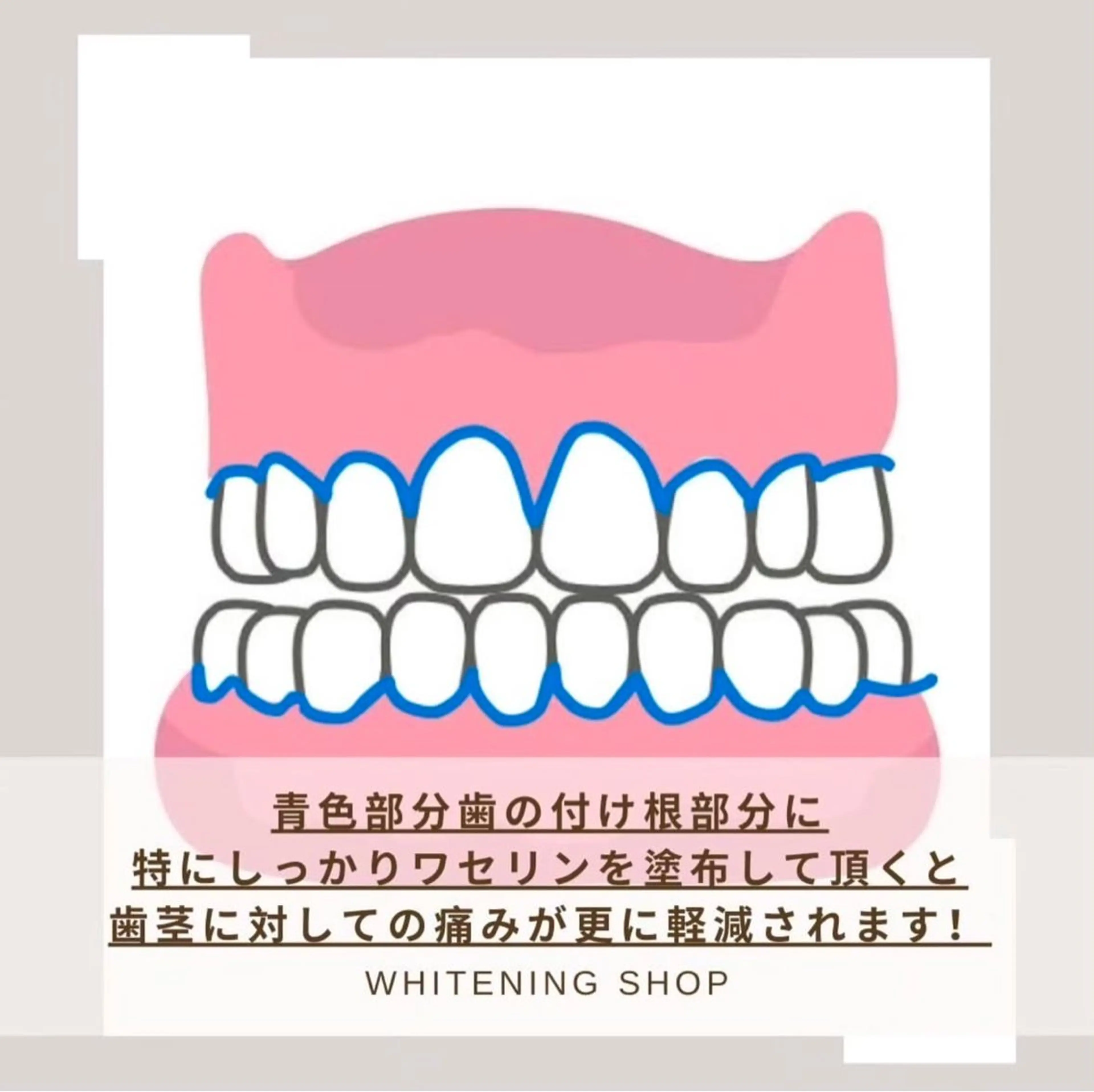 ホワイトニング ショップ伊丹店のその他イメージ