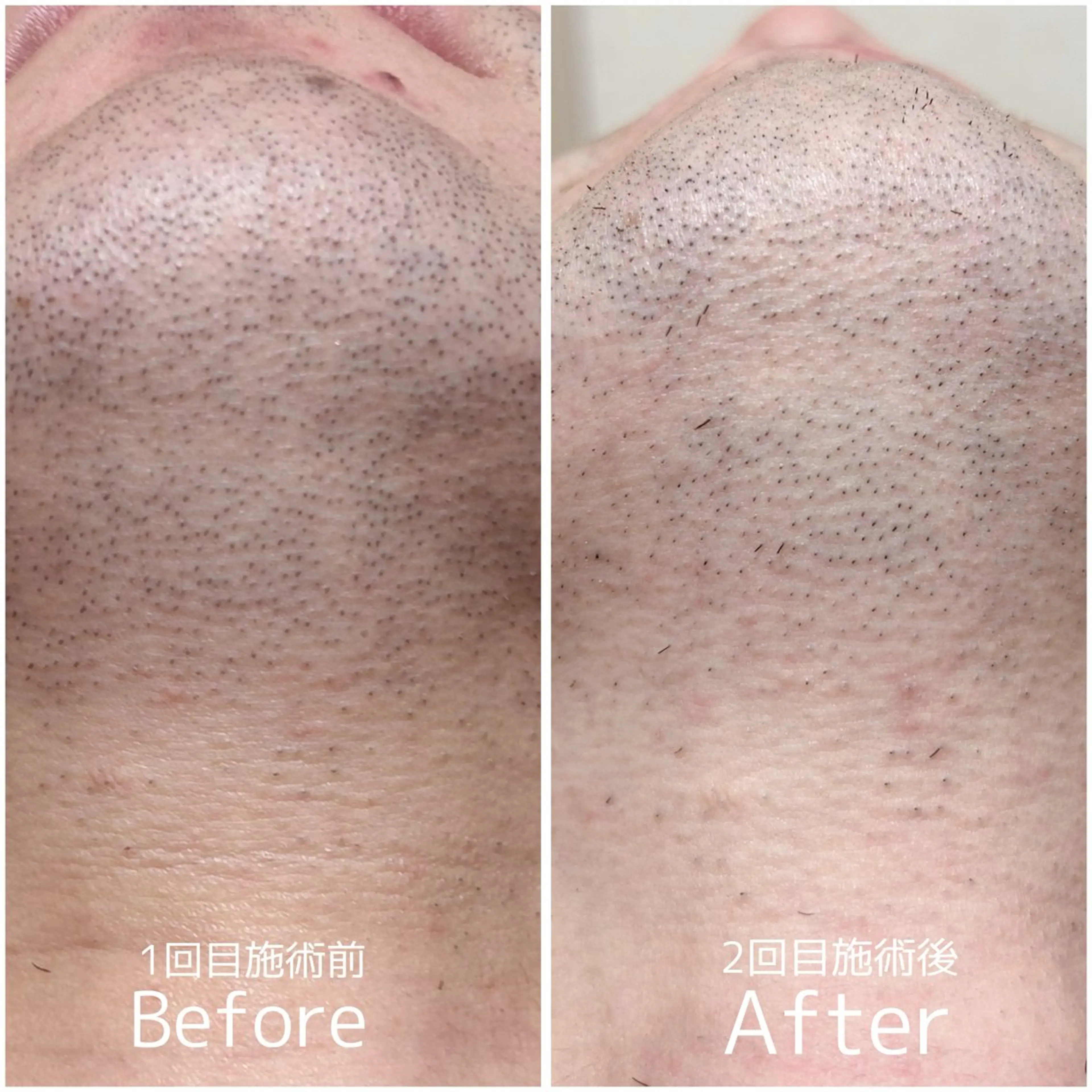 脱毛・ホワイトニング 耳ツボ・美白・毛穴のその他イメージ