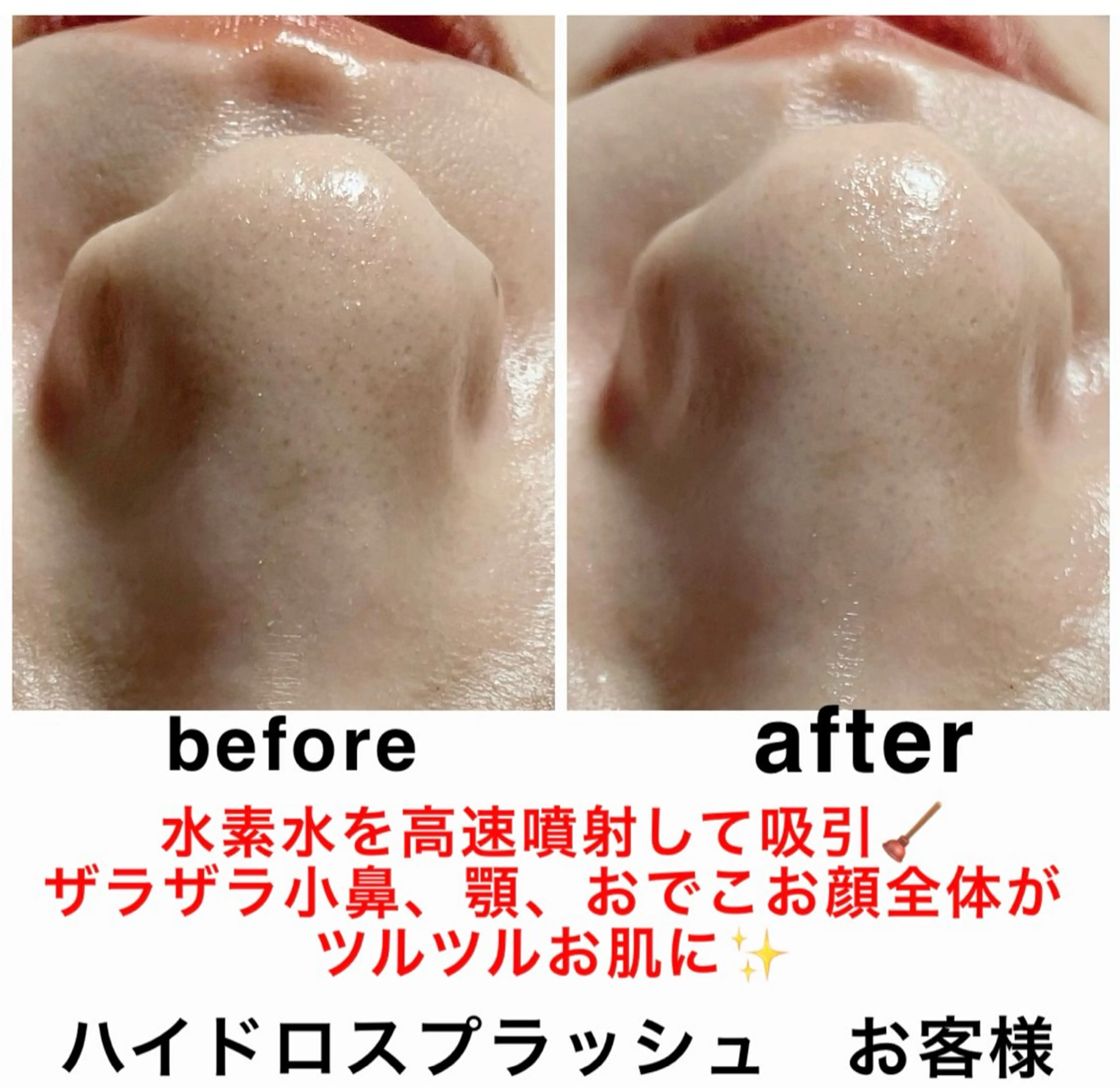 エステ リラク ネイル・エステサロン UILANIのネイルデザイン