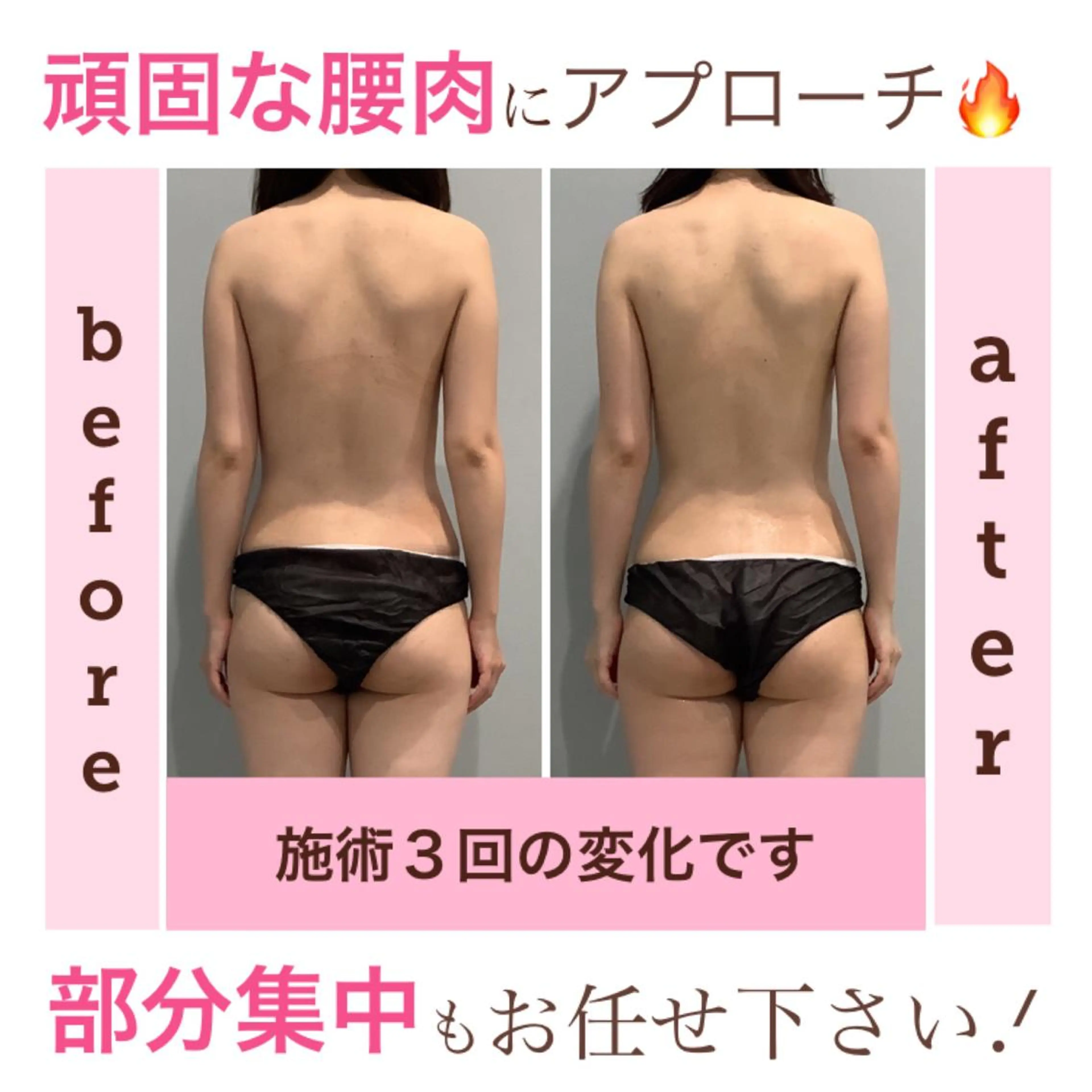 エステ エステサロン JURISのエステ・リラクイメージ