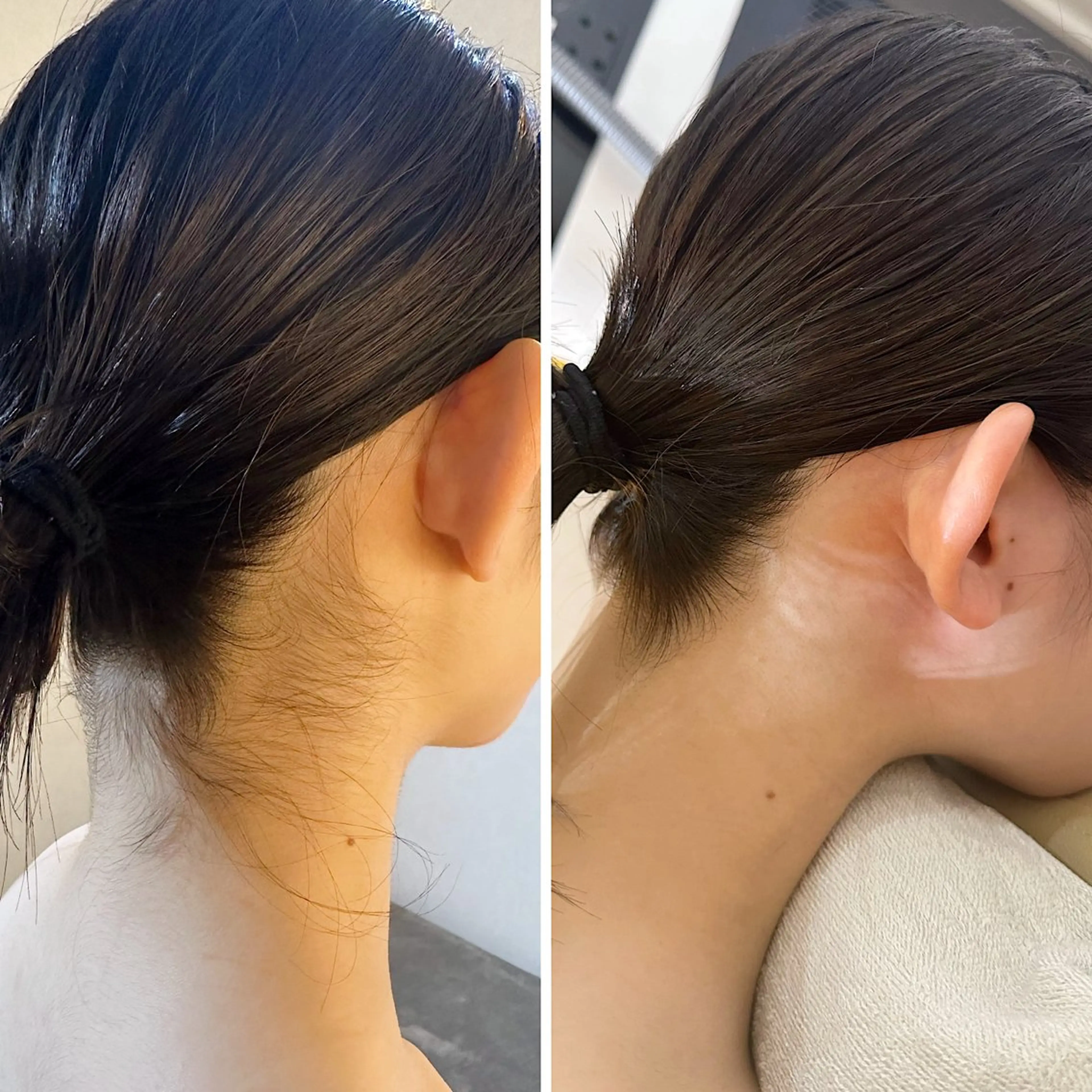 脱毛 うなじ脱毛/美肌脱毛 LABELのエステ・リラクイメージ