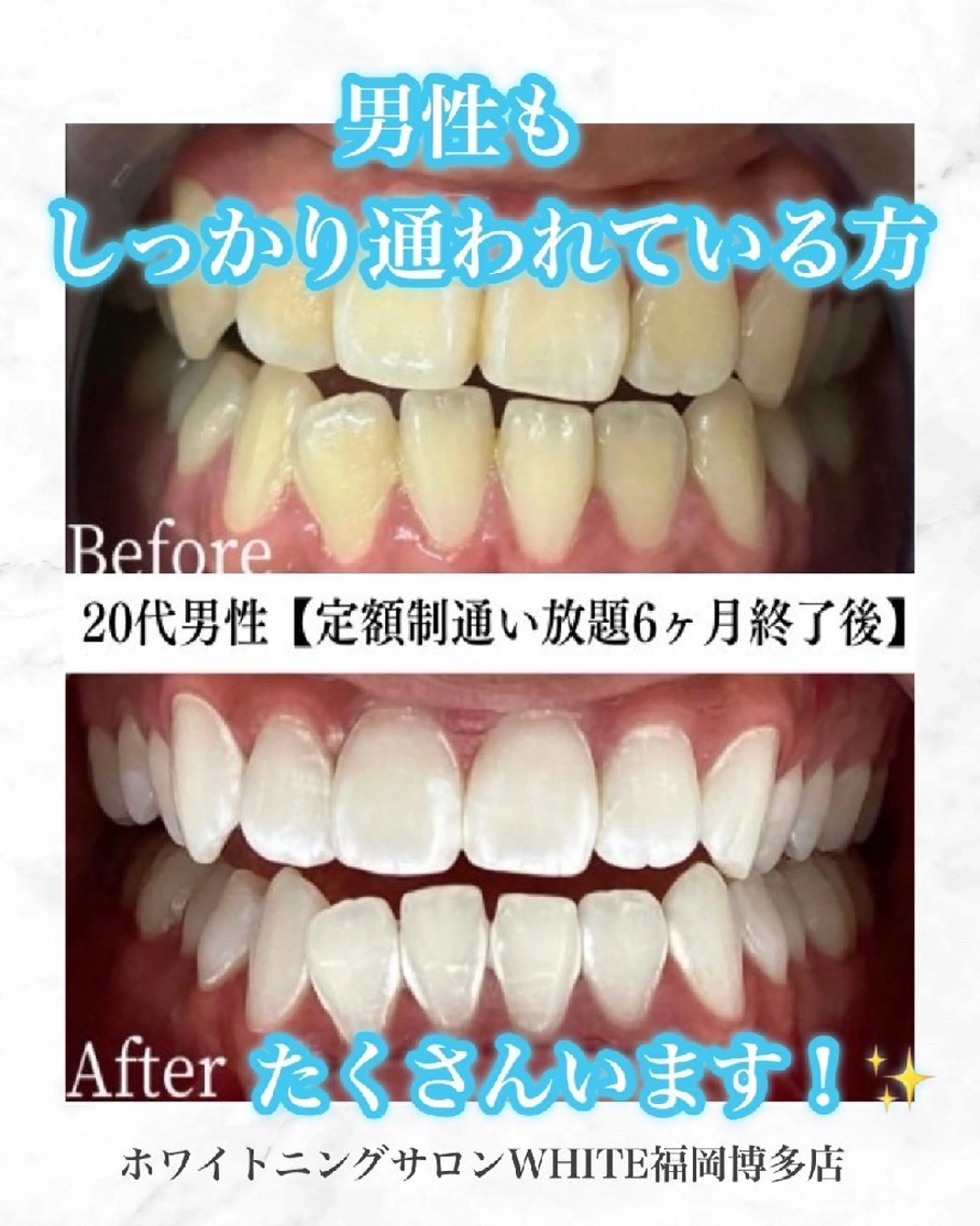 メンズ キッズ エステ リラク セルフホワイトニング WHITE福岡博多店のエステ・リラクイメージ