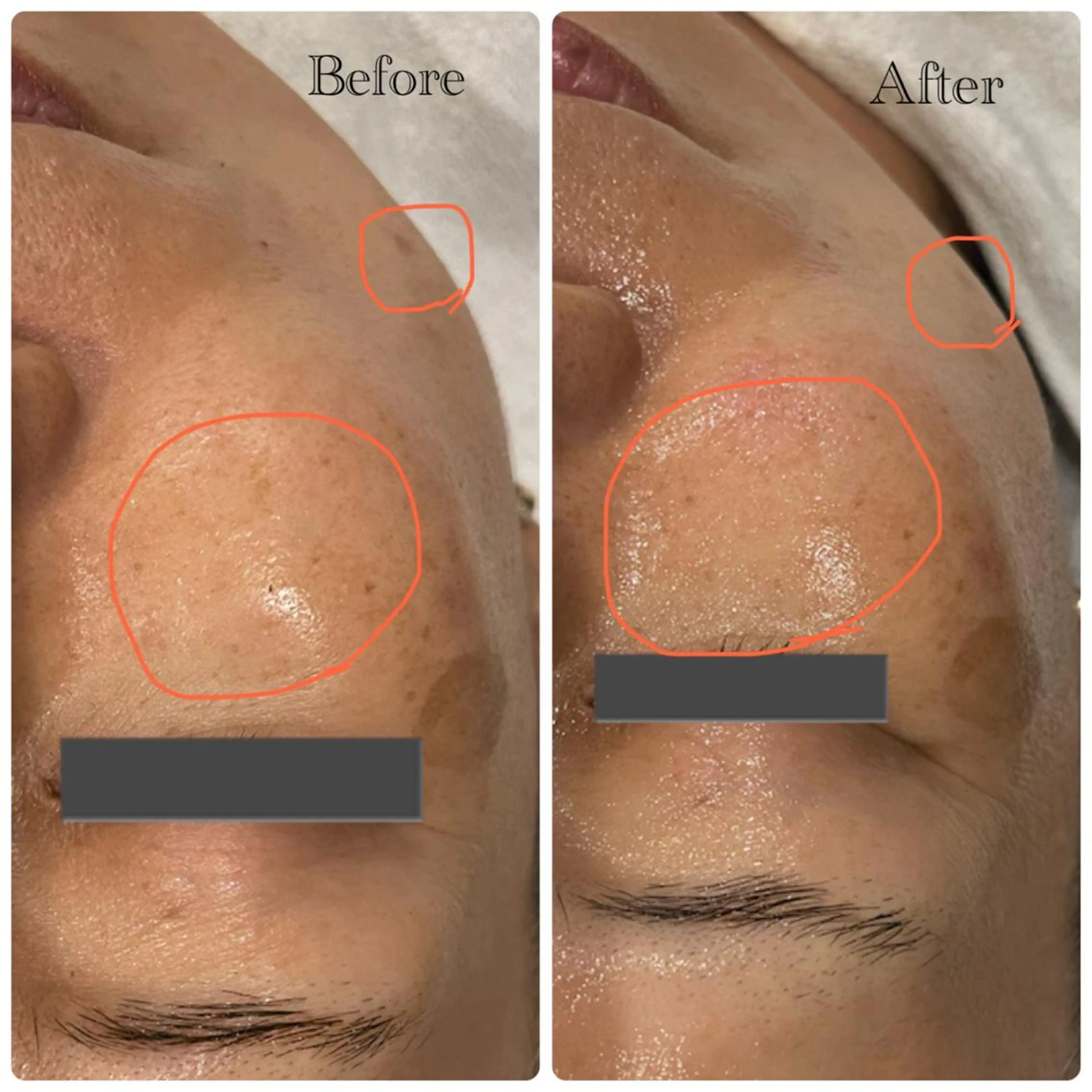 エステ 森口 美空のエステ・リラクイメージ