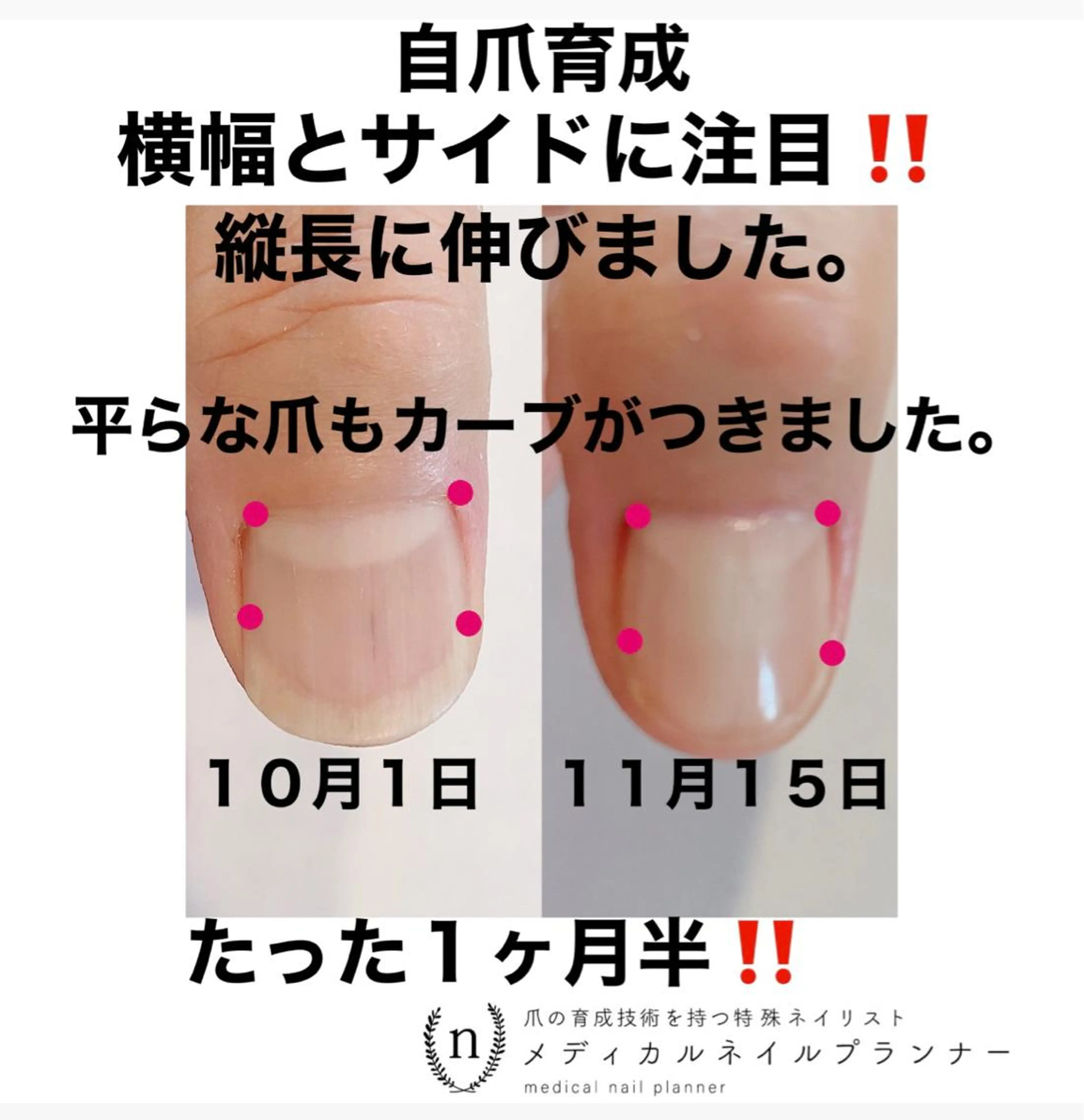 ネイル NAIL SALON ｔｏｇｇｙのネイルデザイン
