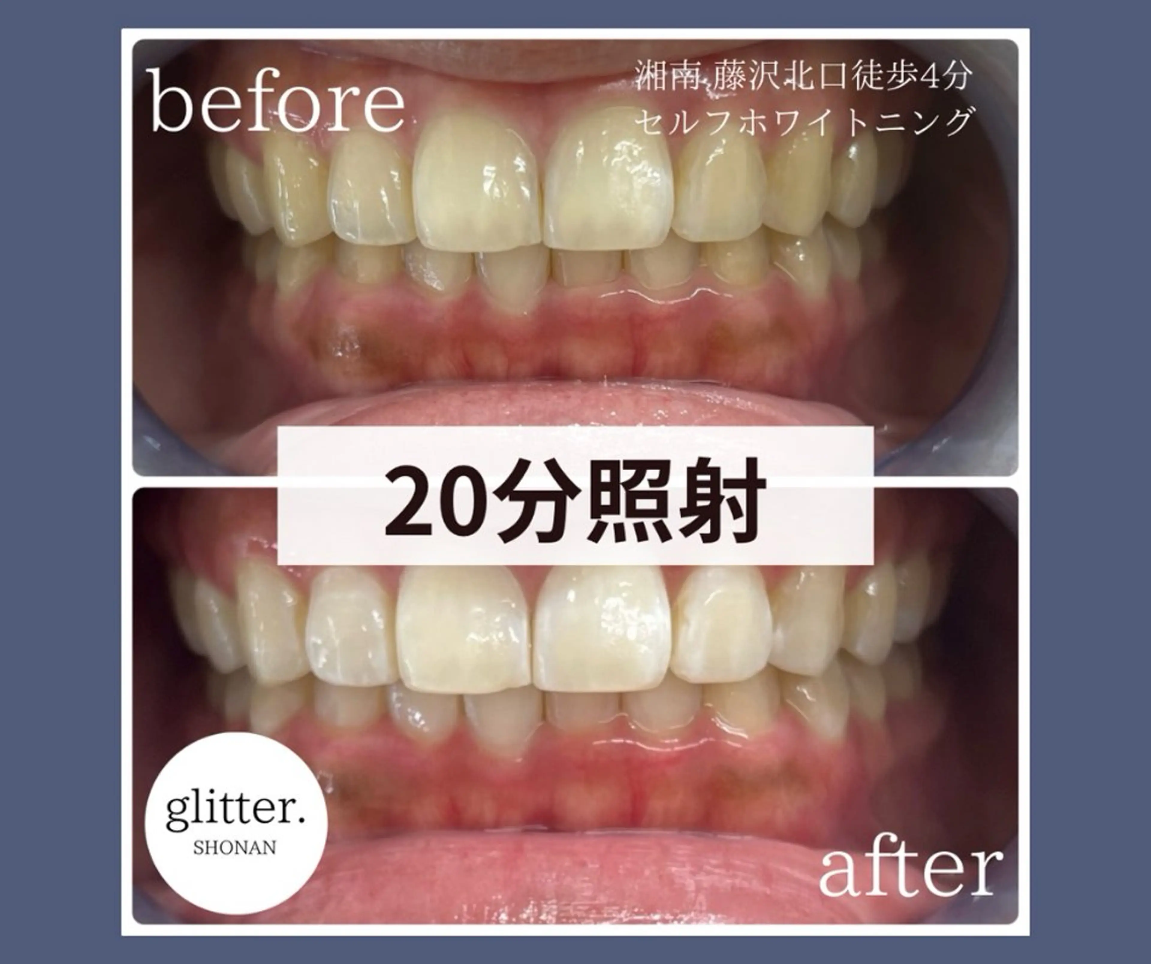 マツエク・マツパ glitter.SHONAN所属・ホワイトニング専門店 glitterのその他イメージ