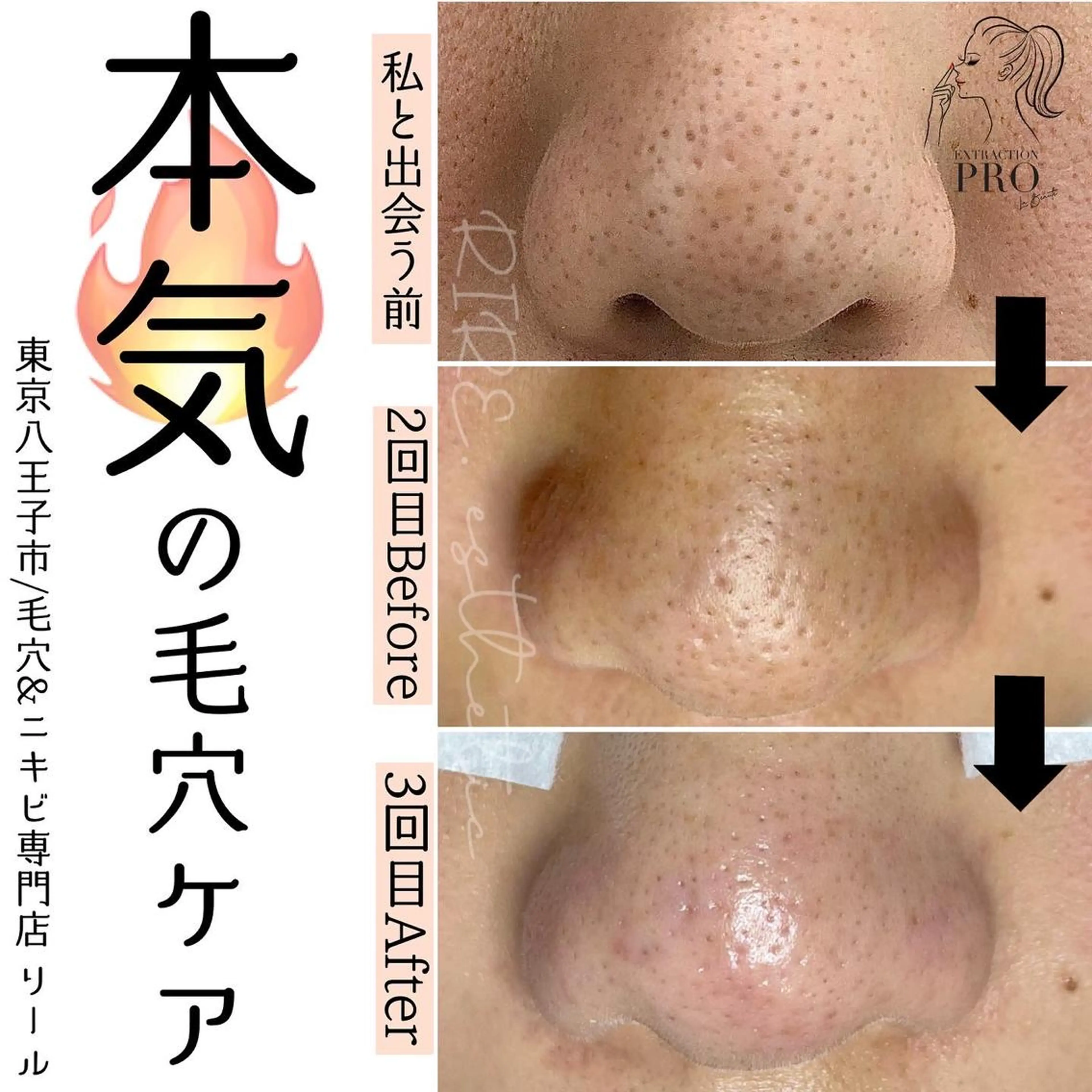 毛穴特化エステ -リールのエステ・リラクイメージ