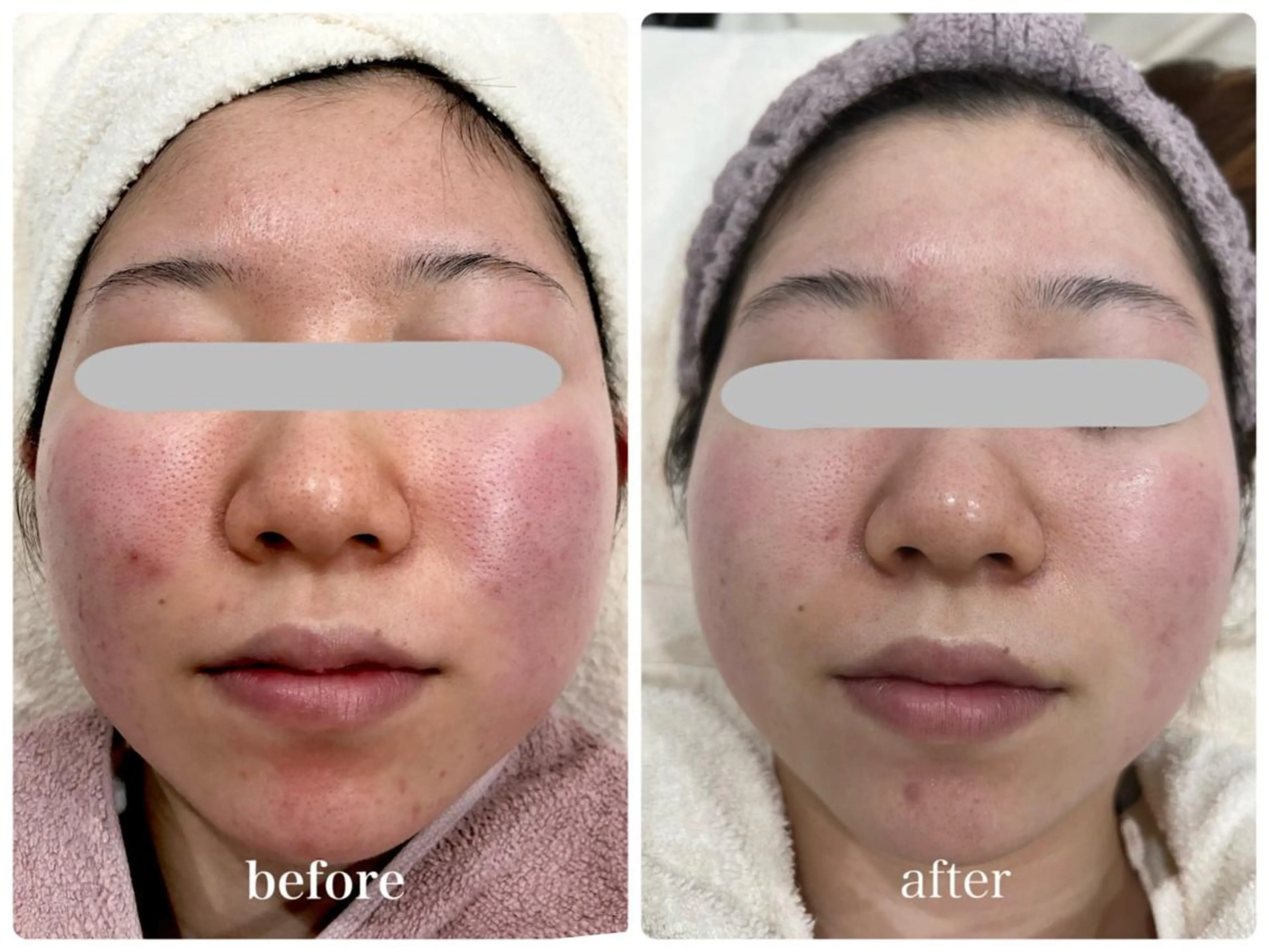 エステティックサロン ベルネのエステ・リラクイメージ