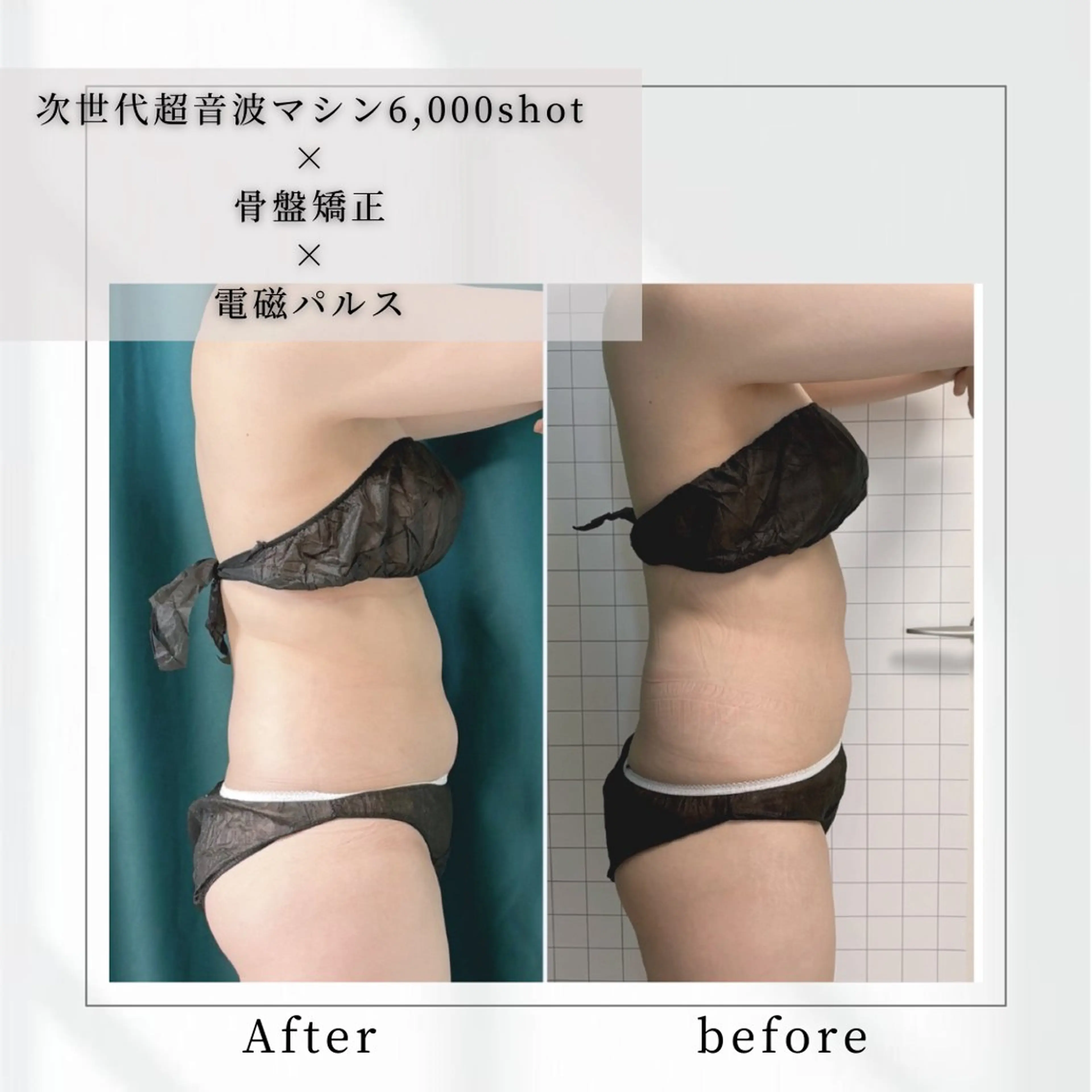 小顔矯正専門店 【RED】池田のエステ・リラクイメージ