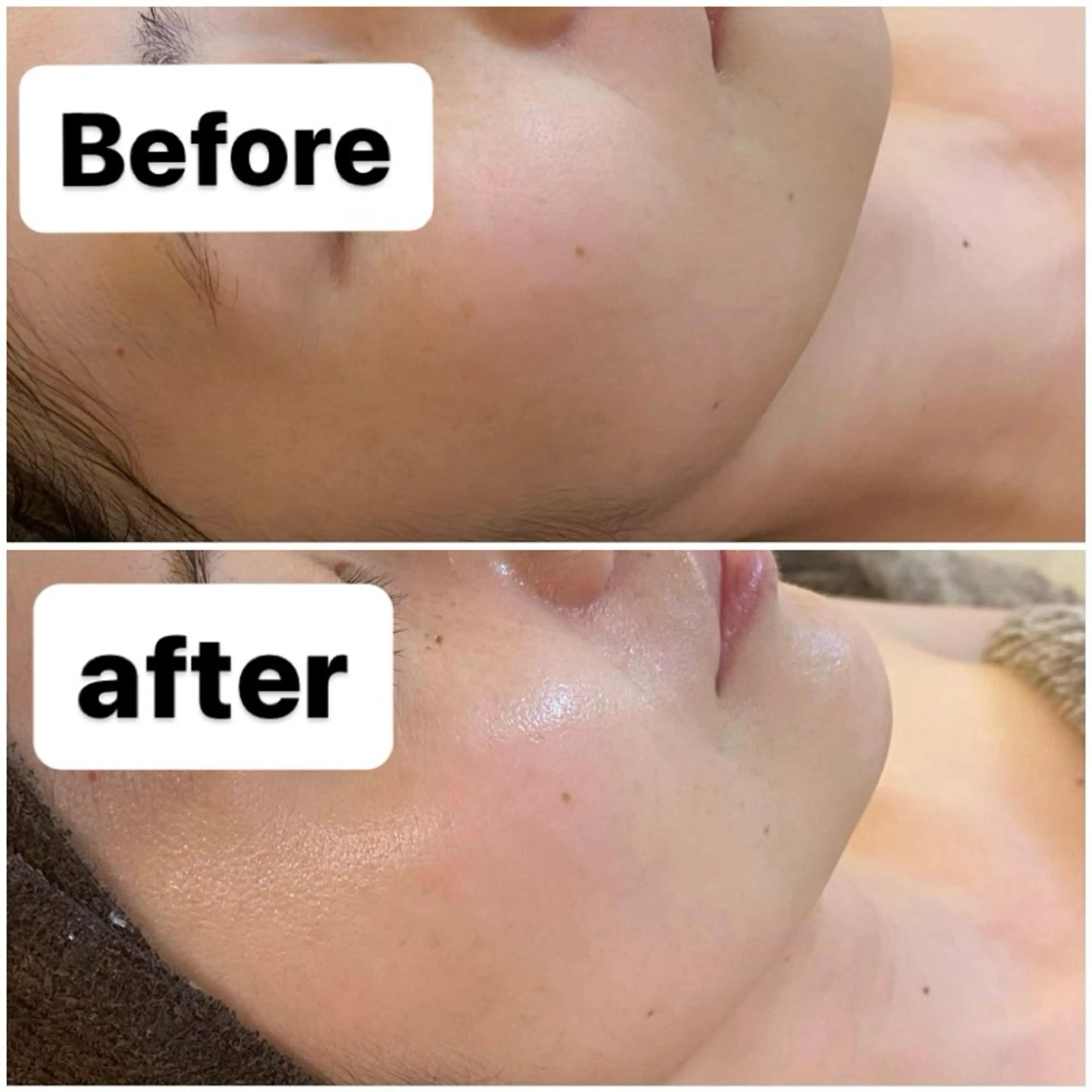 BELCIA福岡店　récolte de BELCIA（レコルトデベルシア）所属・BELCIA福岡店 レコルトデベルシアのエステ・リラクイメージ