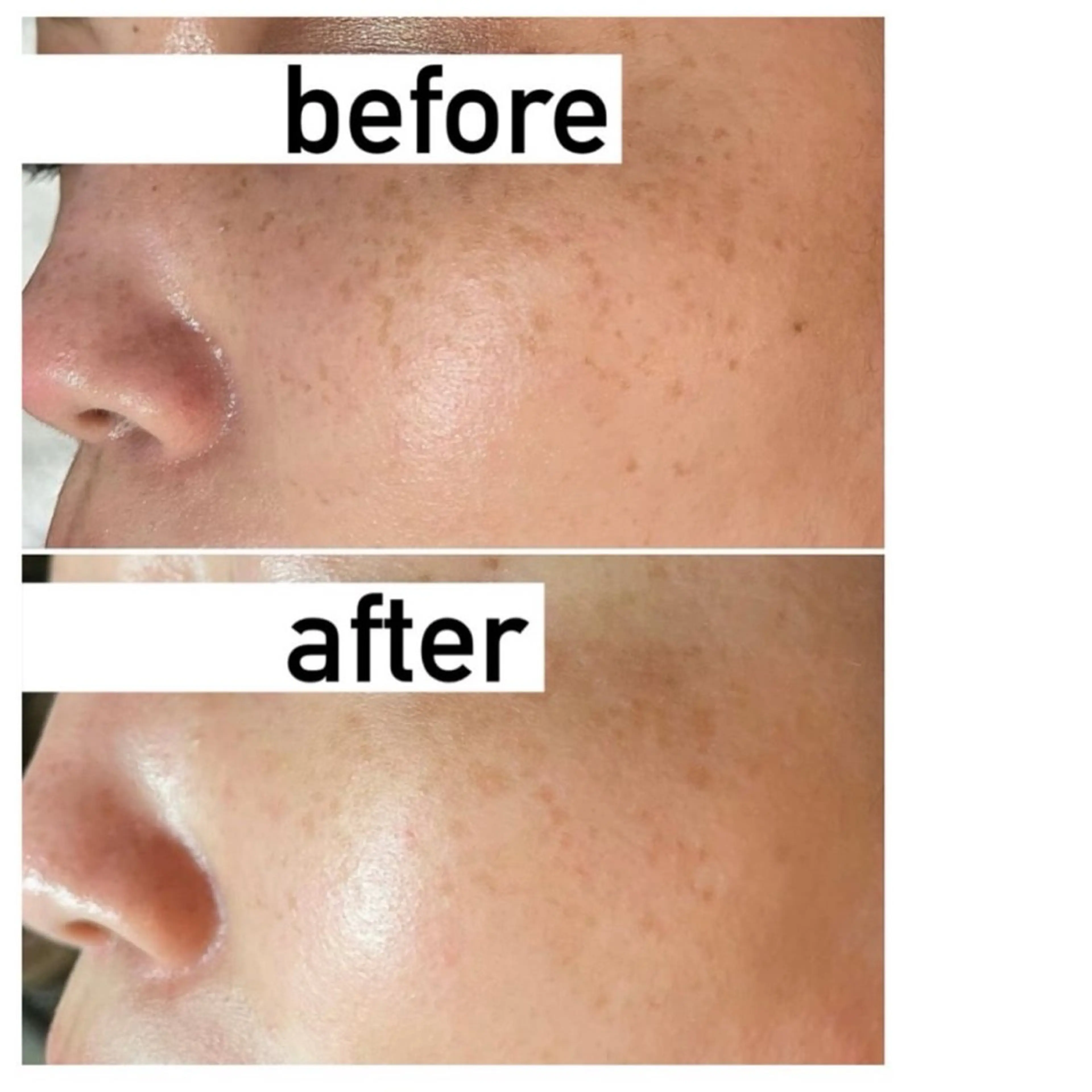 lea'8 lea'8のエステ・リラクイメージ