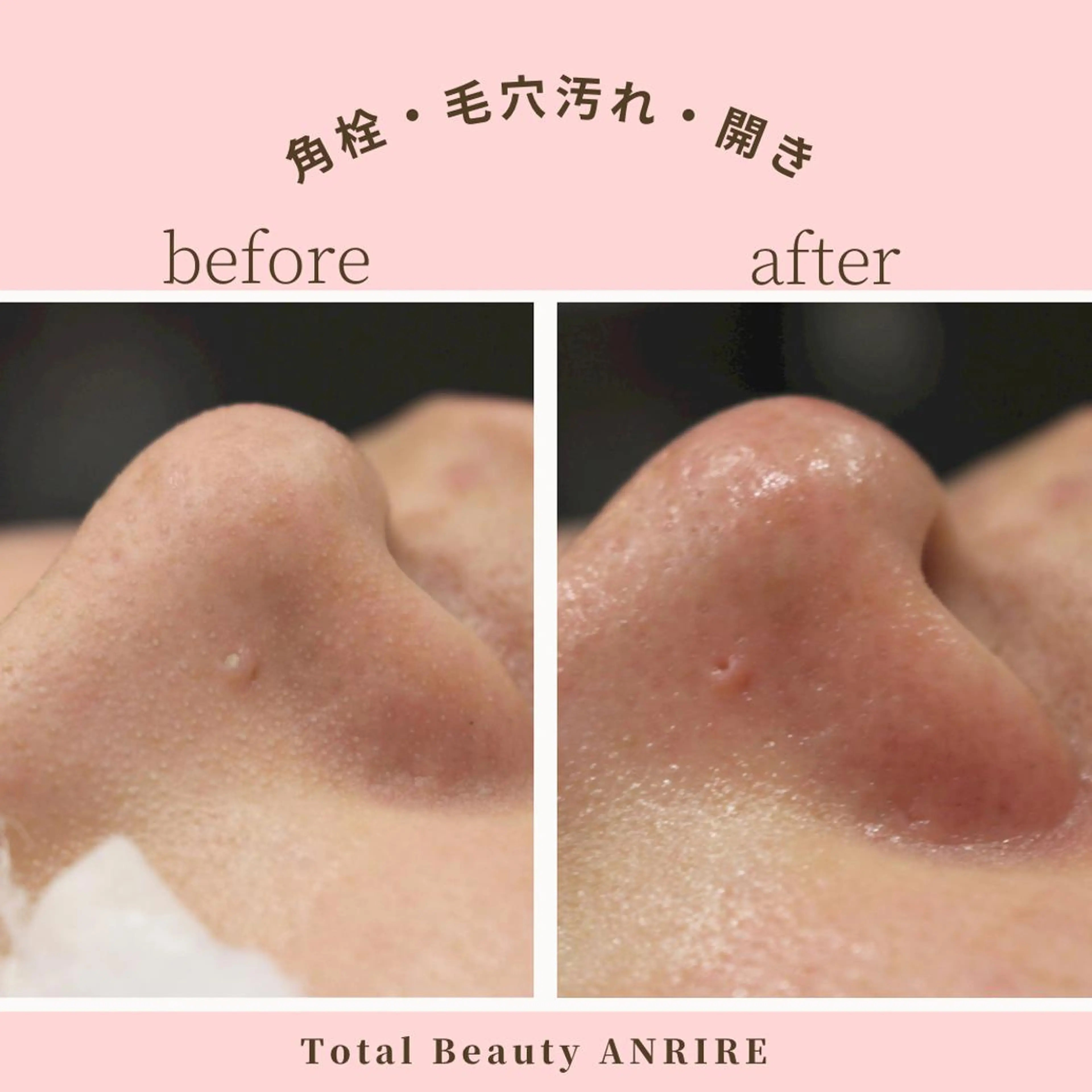 ANRIRE (アンリール)のエステ・リラクイメージ