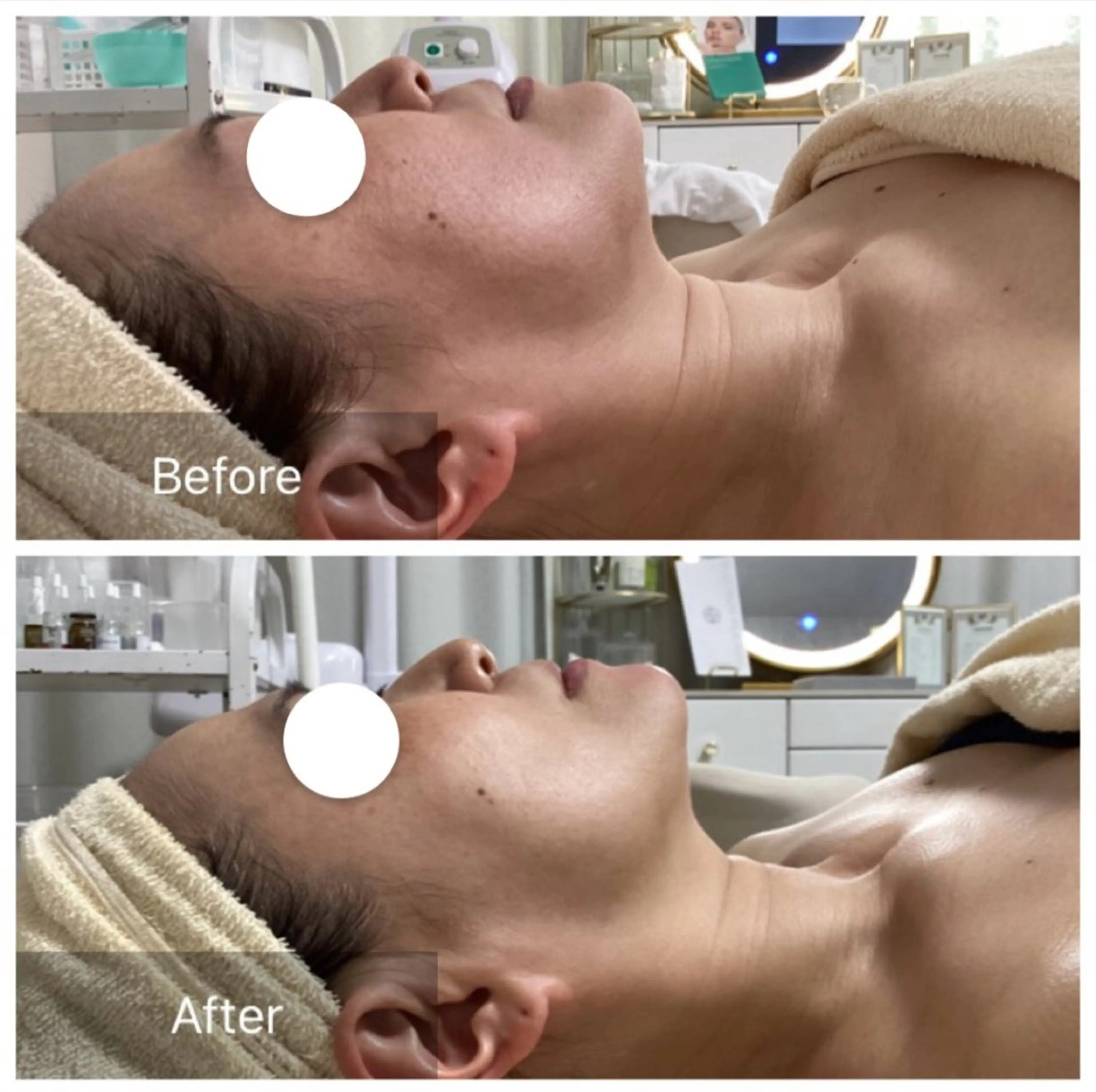 エステ Dahlia Moriのエステ・リラクイメージ