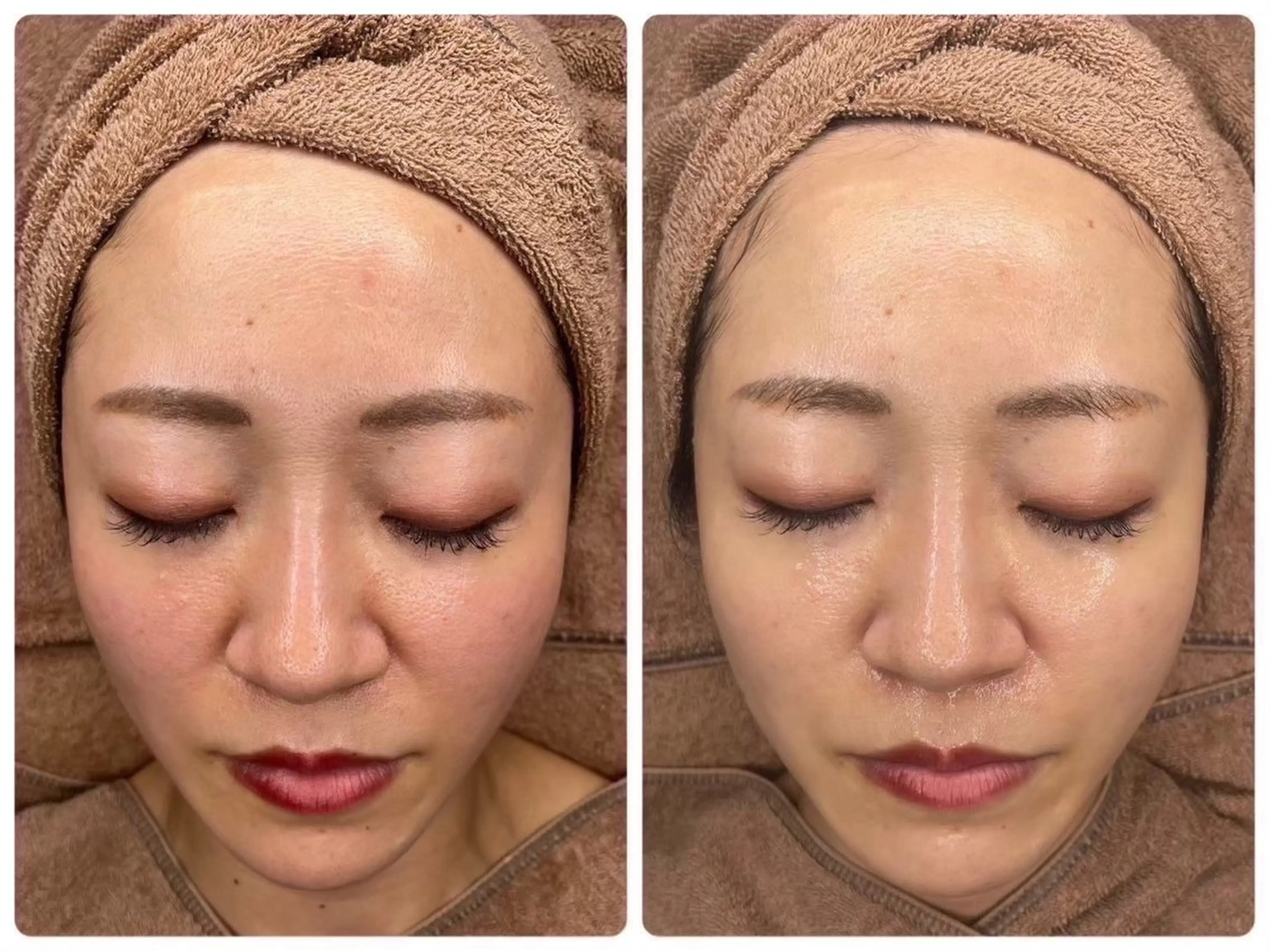 中目黒ハーブピーリン グ🌿ララピールのエステ・リラクイメージ