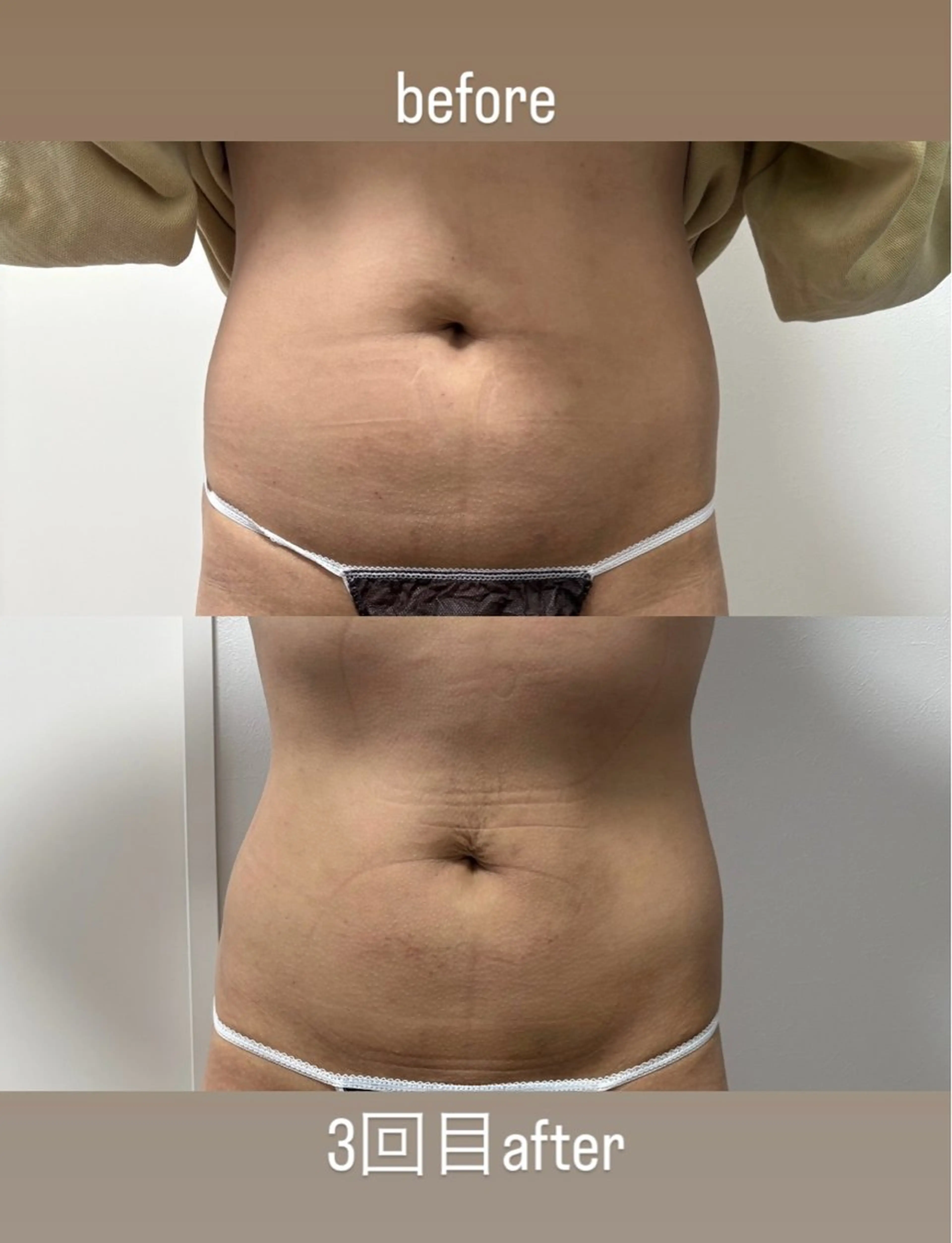 エステ 石巻 冷却痩身 Miiju. 鈴木のエステ・リラクイメージ