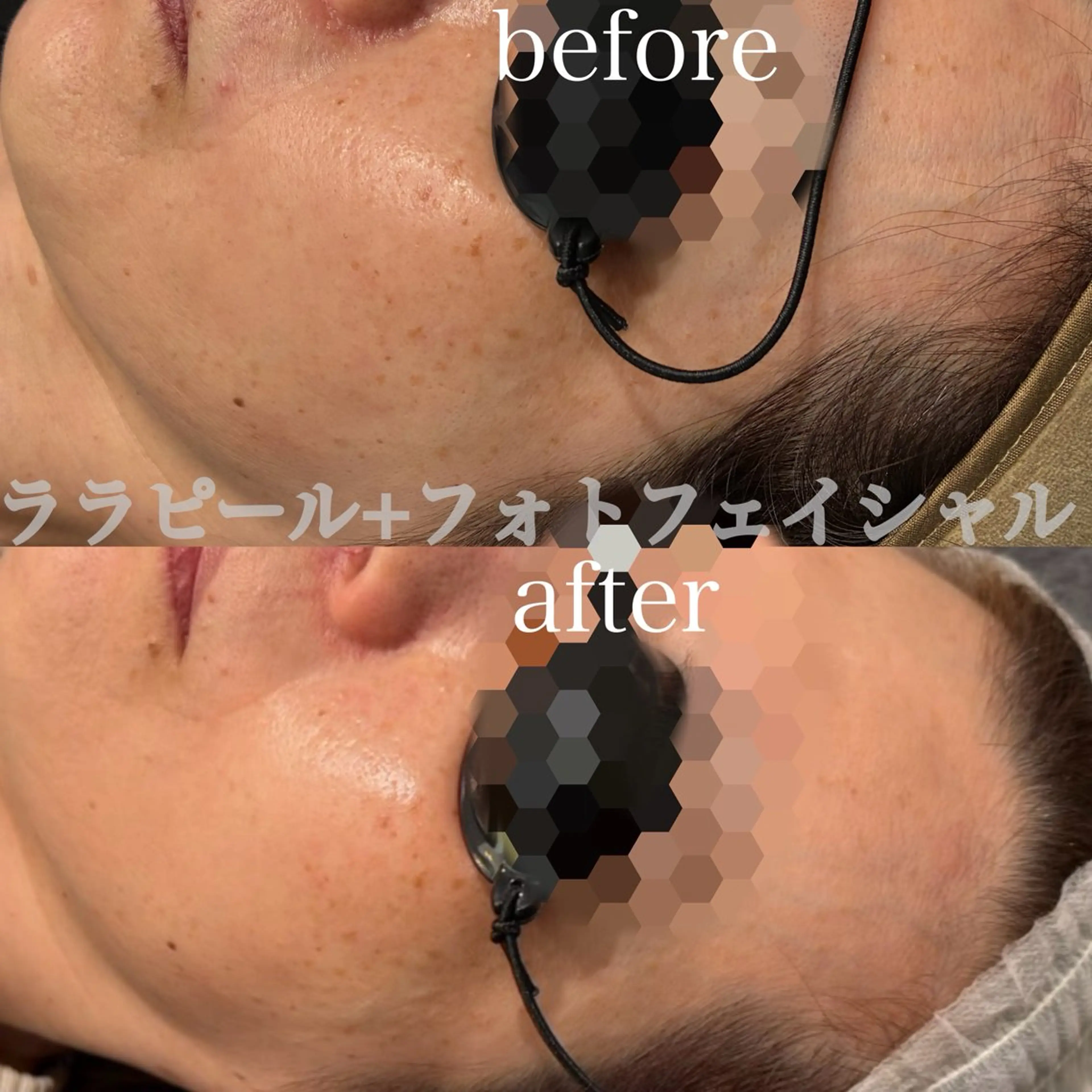エステ Esthetic ReTweetのエステ・リラクイメージ
