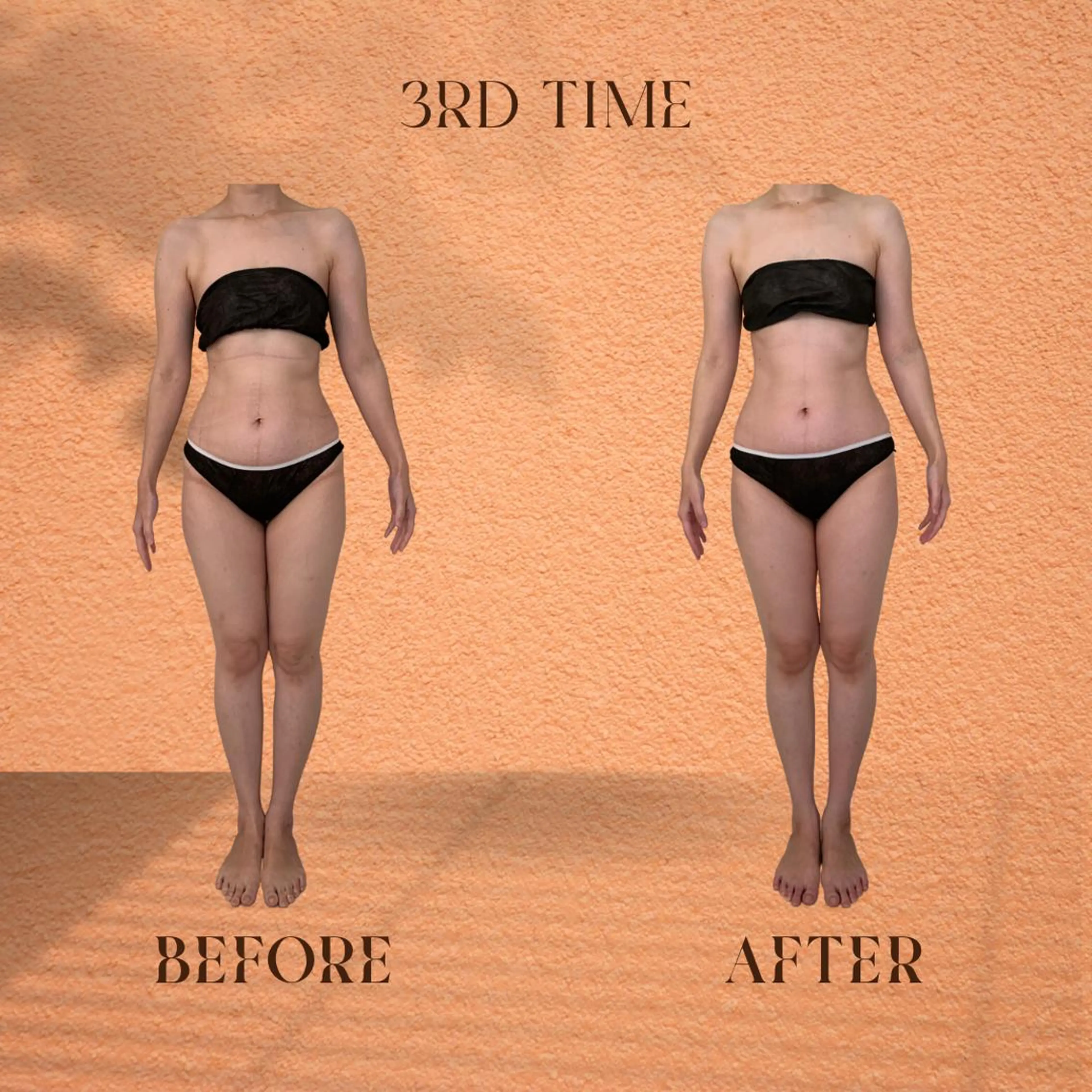 【ミニモ新規限定価格🩷セルライト×歪みケア】スウェディッシュトリートメント 筋膜リリース全身(価格16500円)の写真