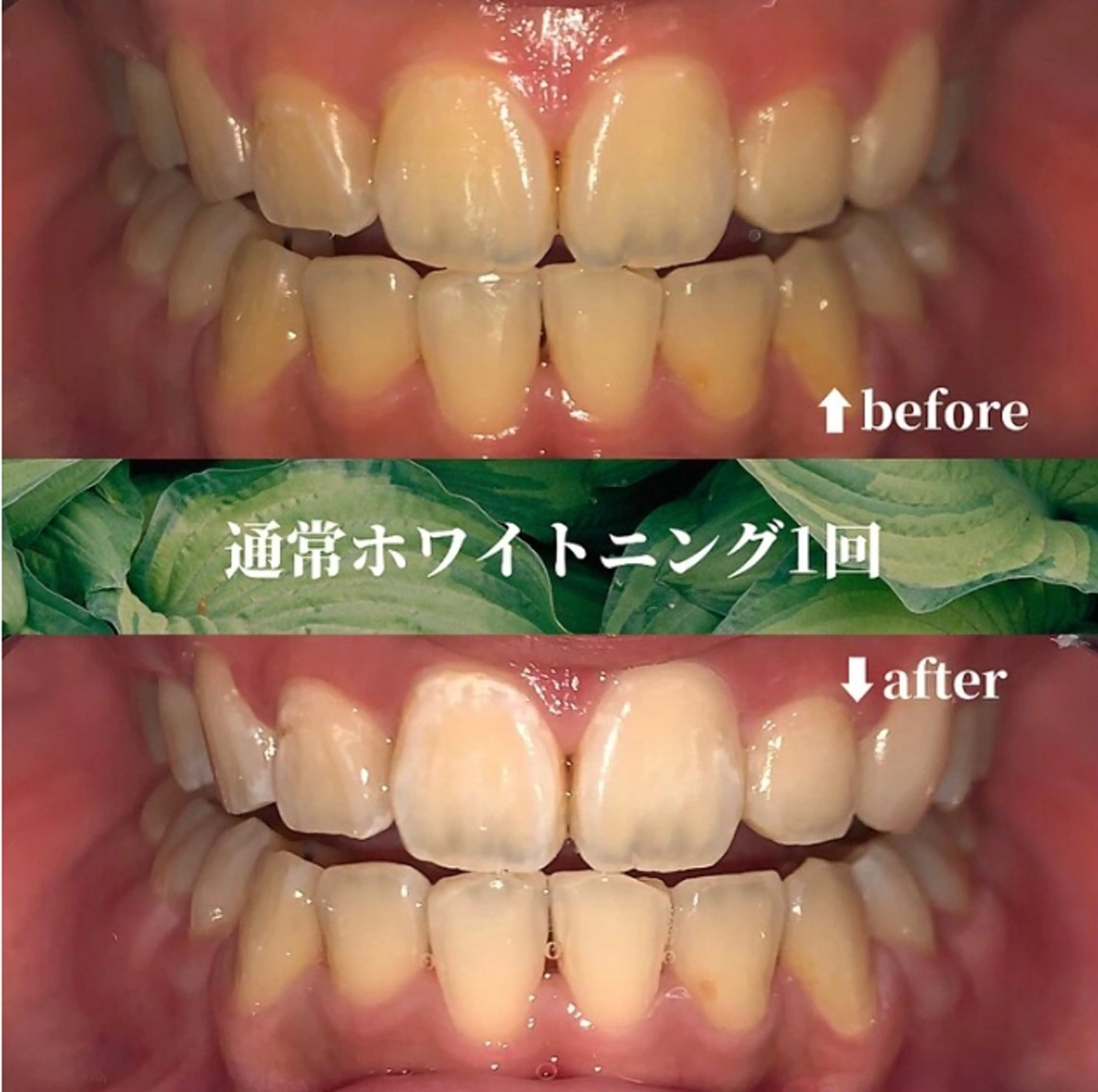 futaba ホワイトニング/天神のエステ・リラクイメージ