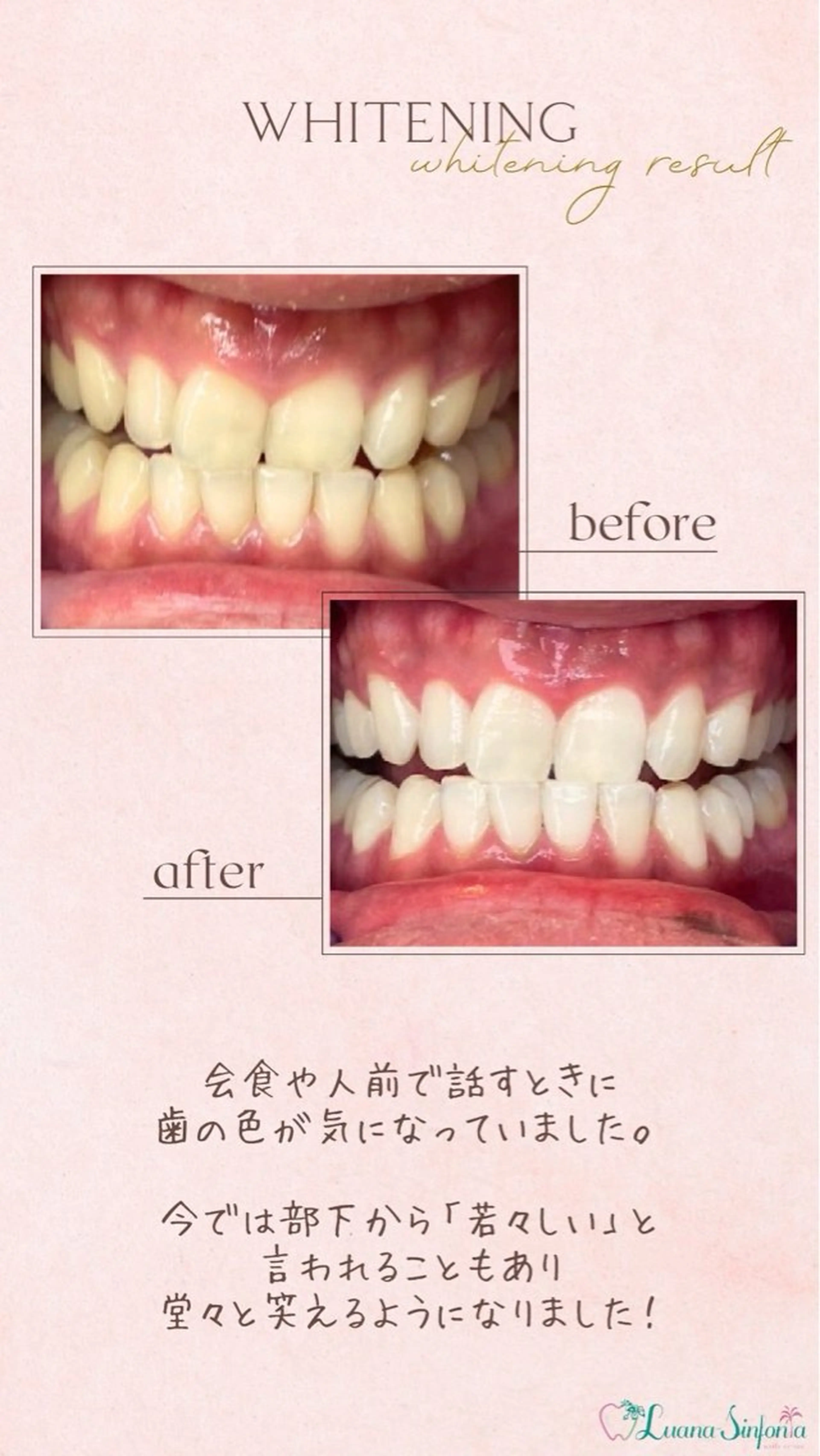 橋口 花菜子のその他イメージ