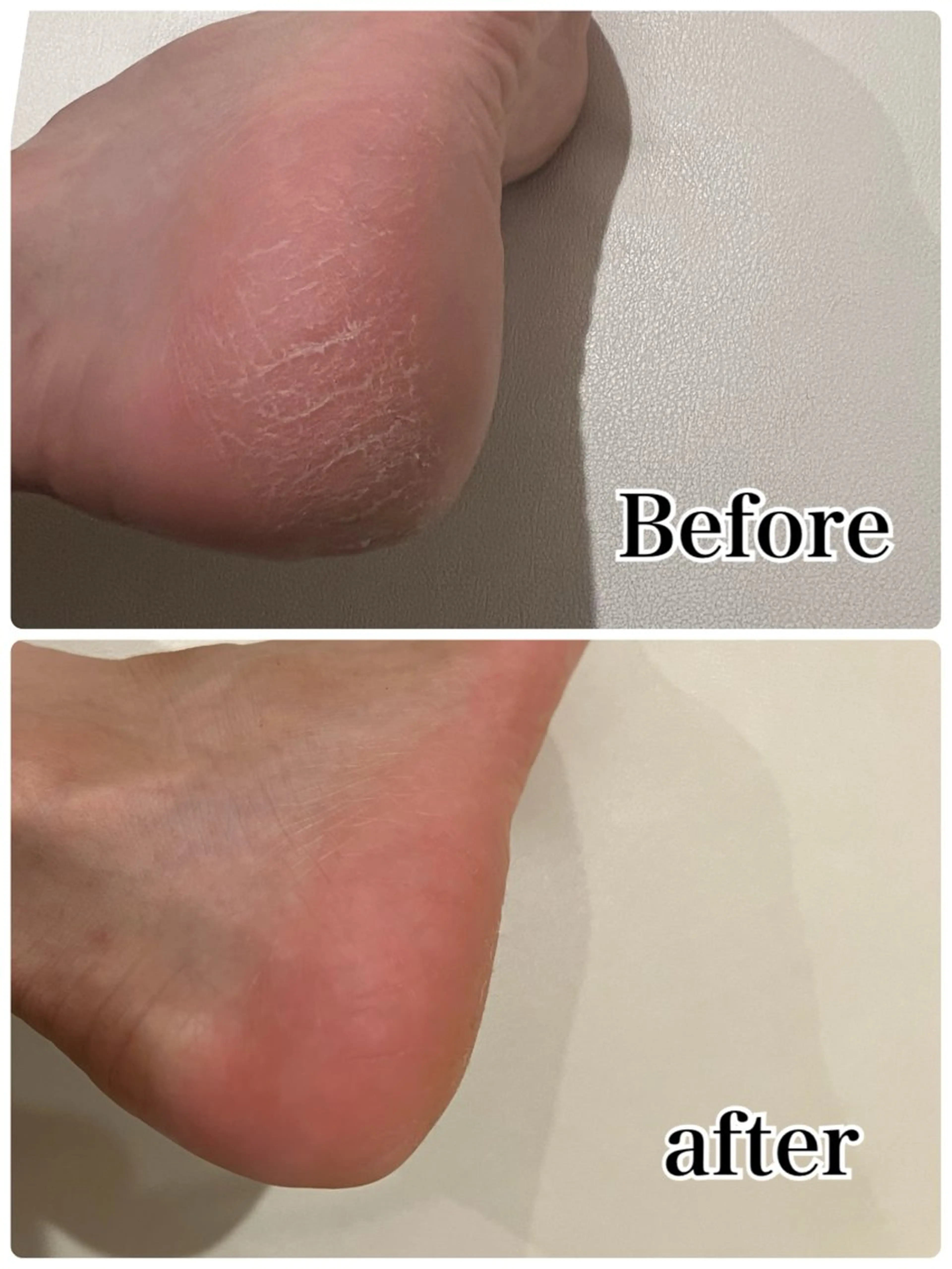 ❤︎MN❤︎ モンのエステ・リラクイメージ