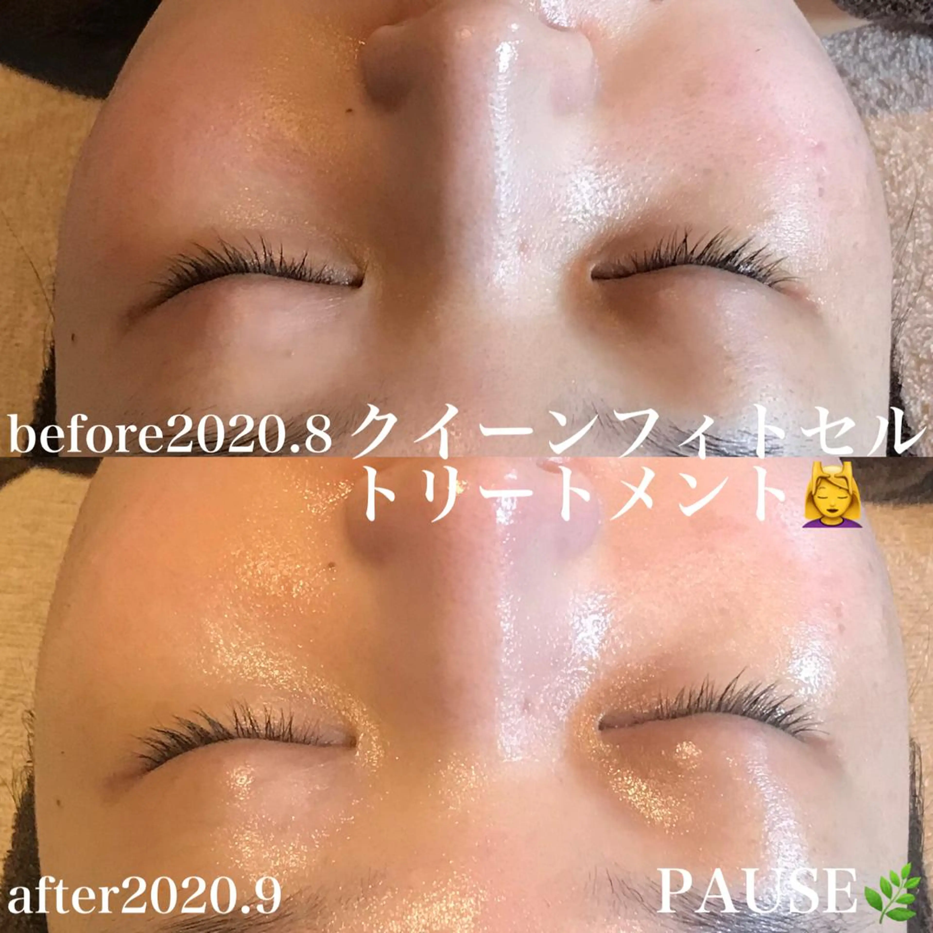 エステ 浜野 恵美のエステ・リラクイメージ