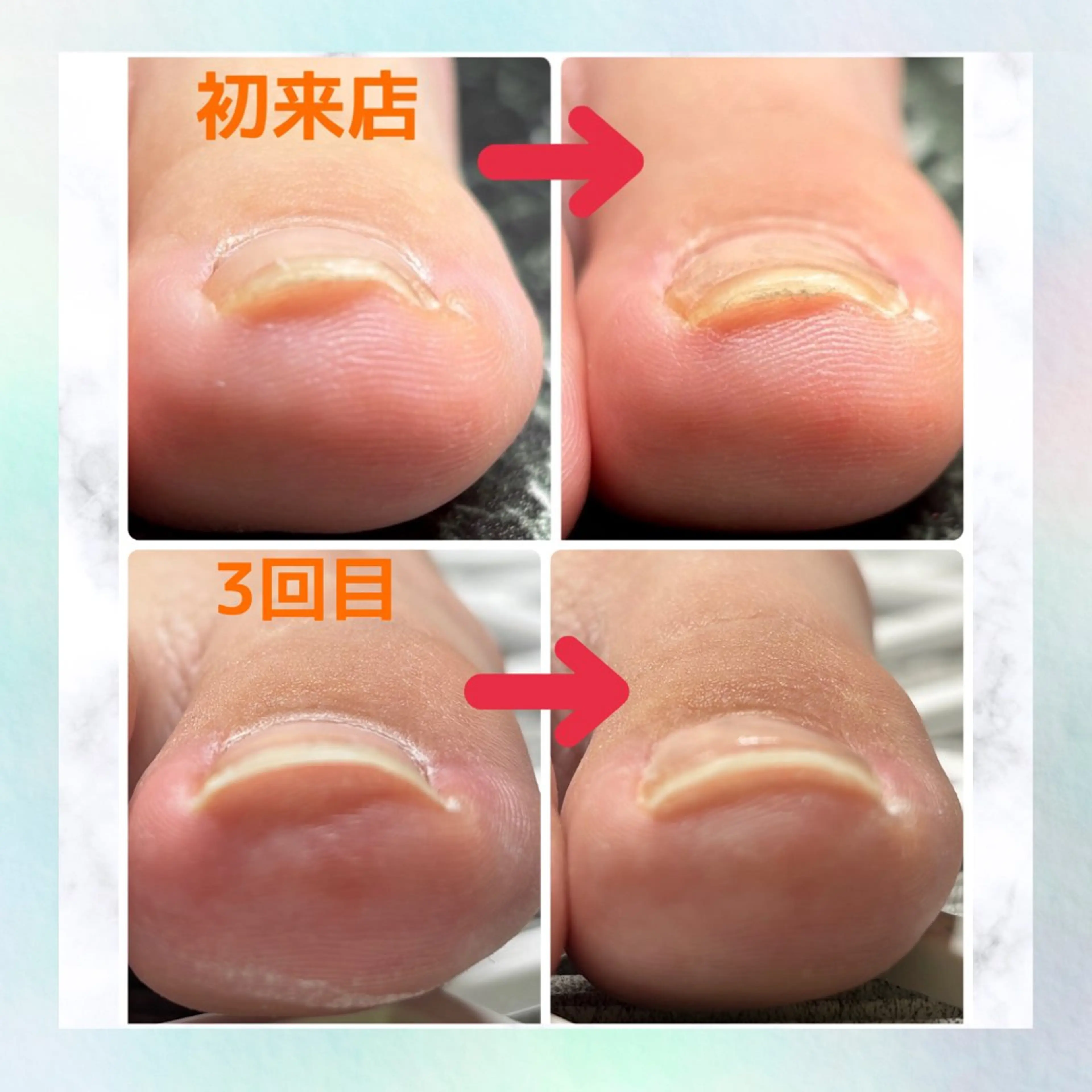 ネイル その他(ネイル) NAIL K-PIT ネイル ケーピットの眉毛・アイブロウイメージ