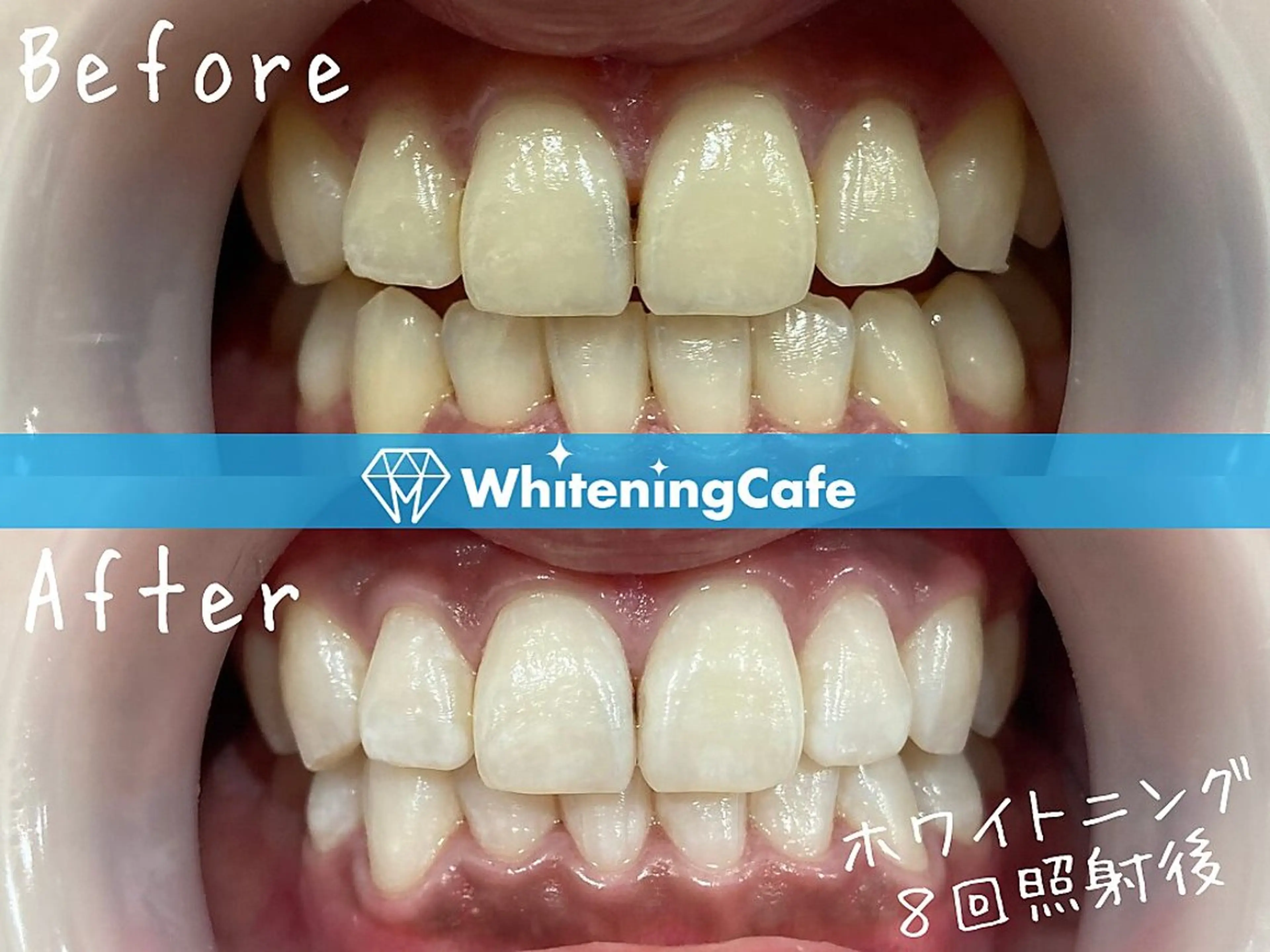 ホワイトニングカフェ 原宿店のエステ・リラクイメージ