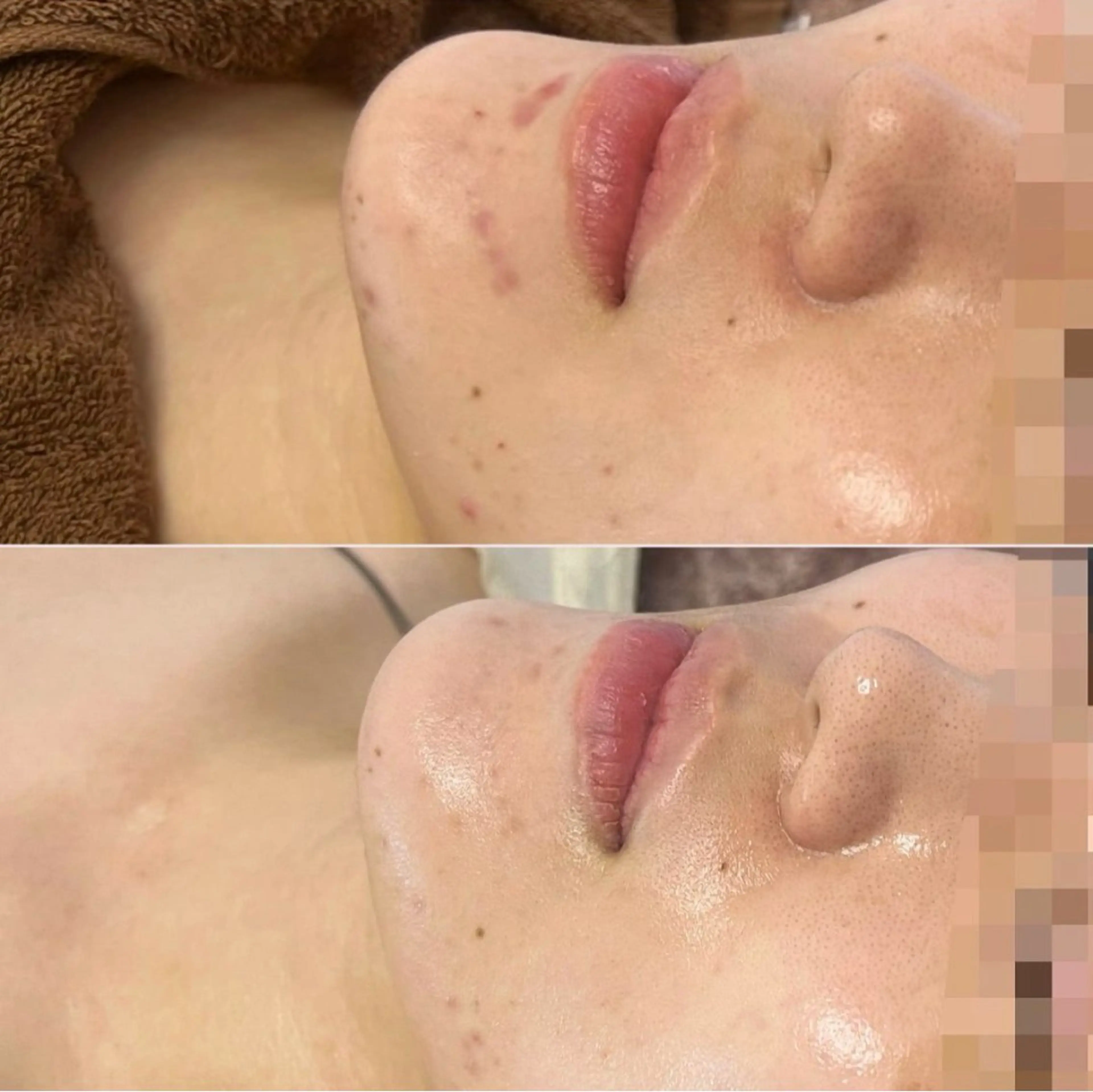 エステ 看護師が施術する美容 ナスサロ/鈴木のエステ・リラクイメージ