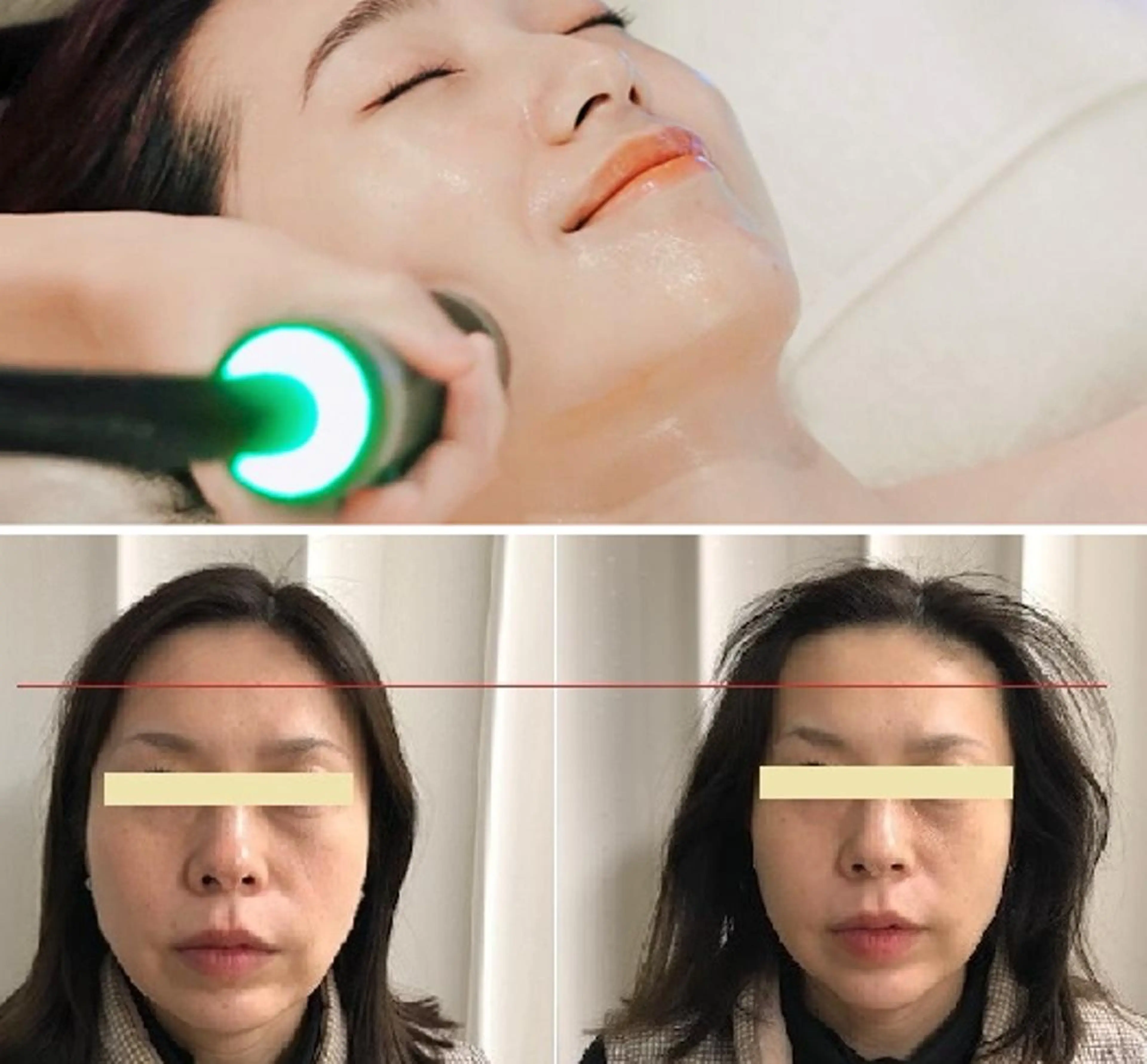 エステ 顔脱毛＆毛穴＆ニキビ 優良№1♪ヒロコ♪のエステ・リラクイメージ