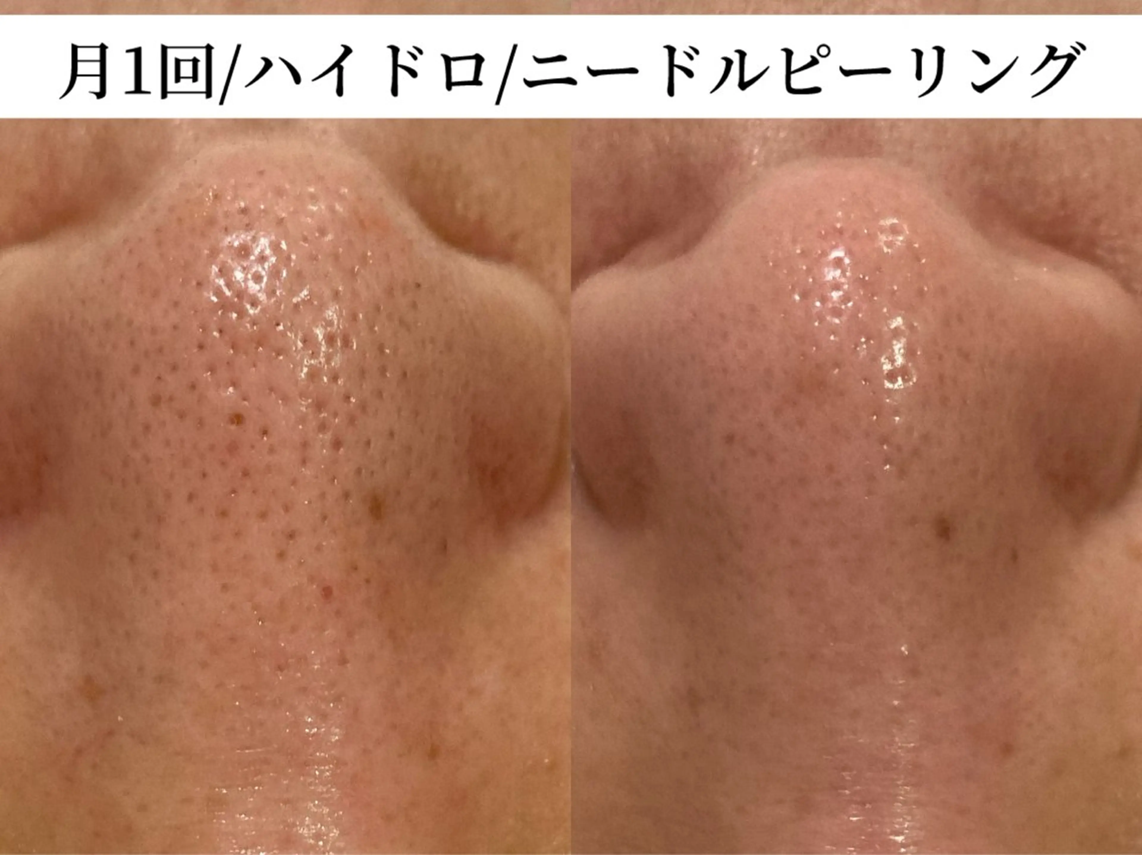 TRINIENCE 南流山店のエステ・リラクイメージ