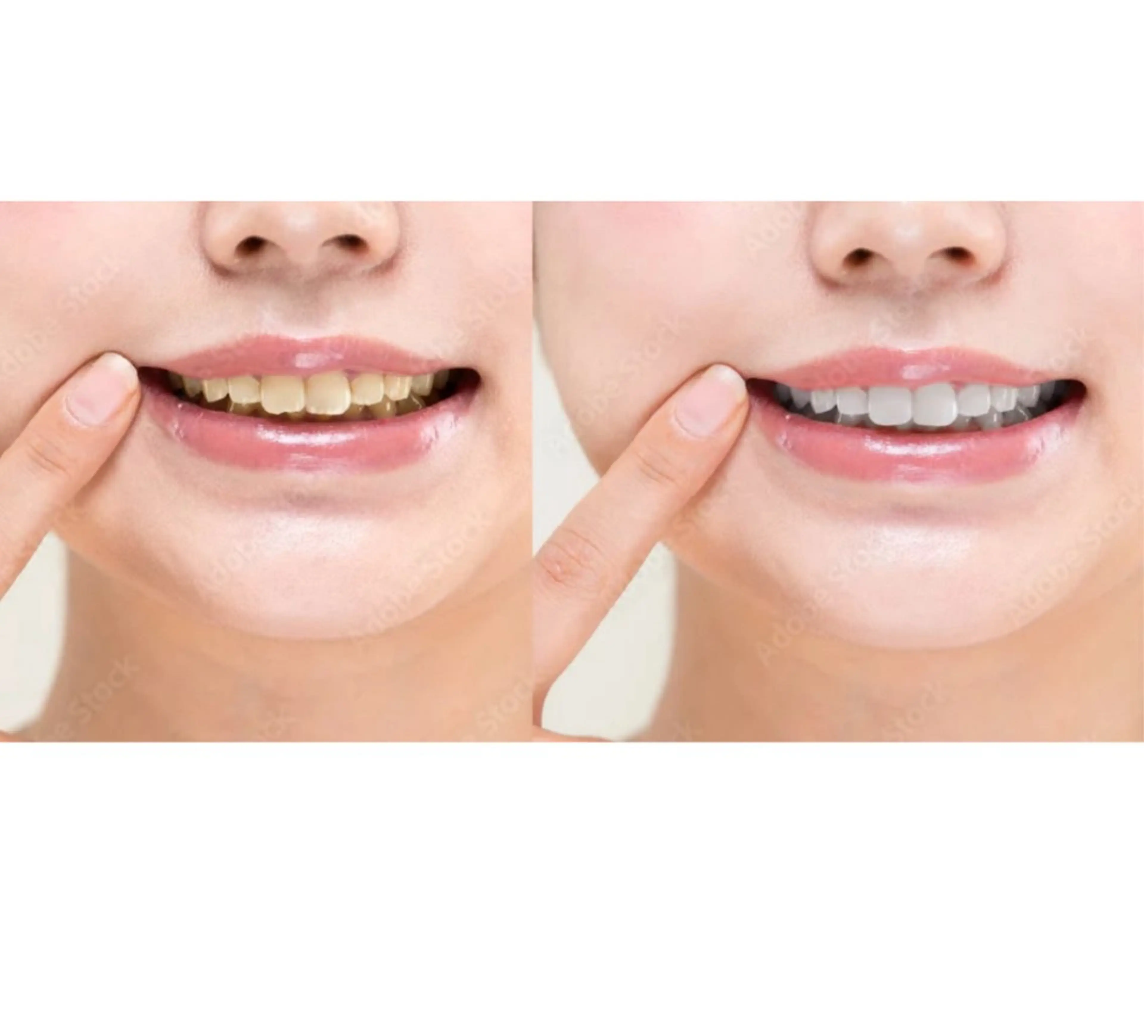 Fullcover beautyのその他イメージ