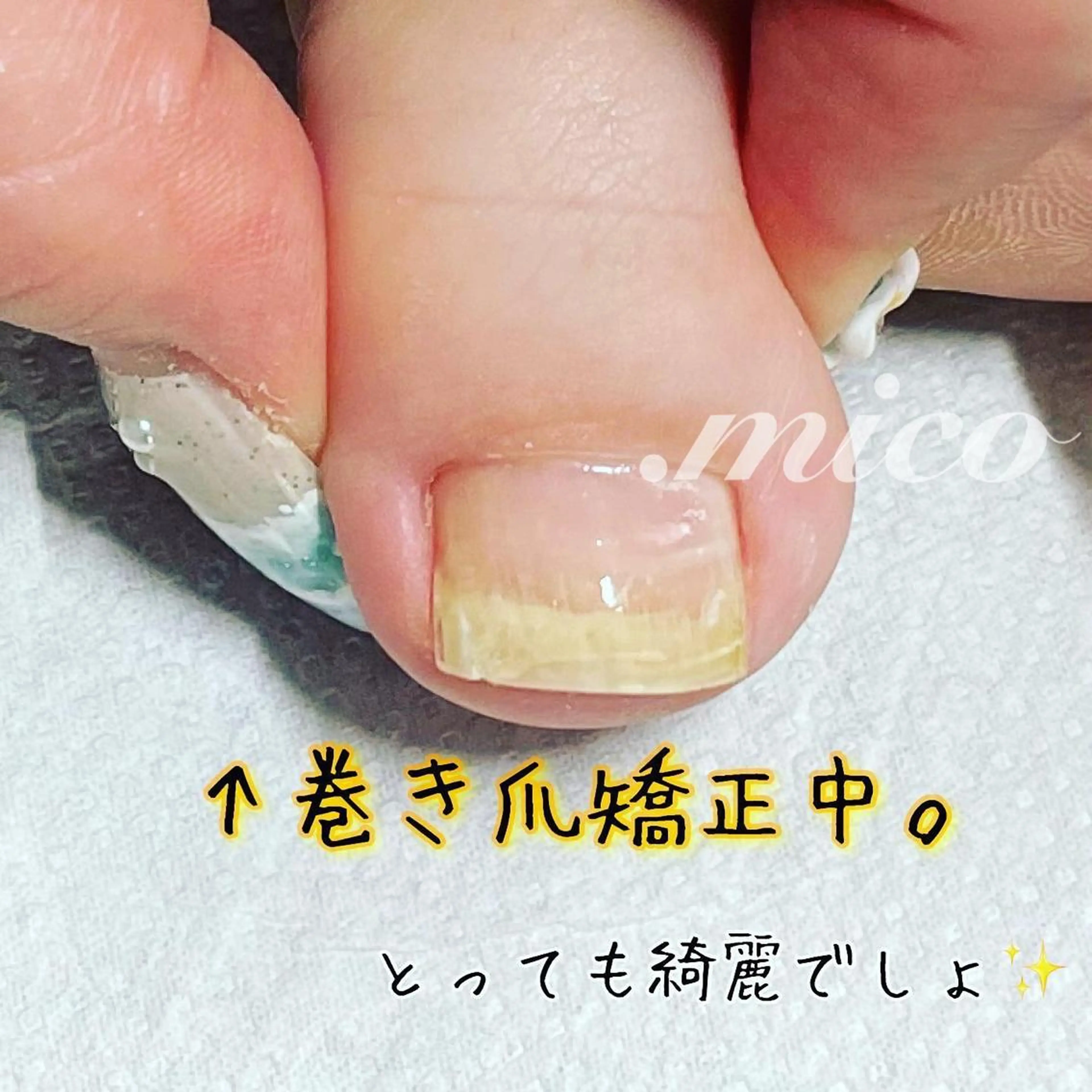 ネイル 爪の専門店 by.micoのネイルデザイン