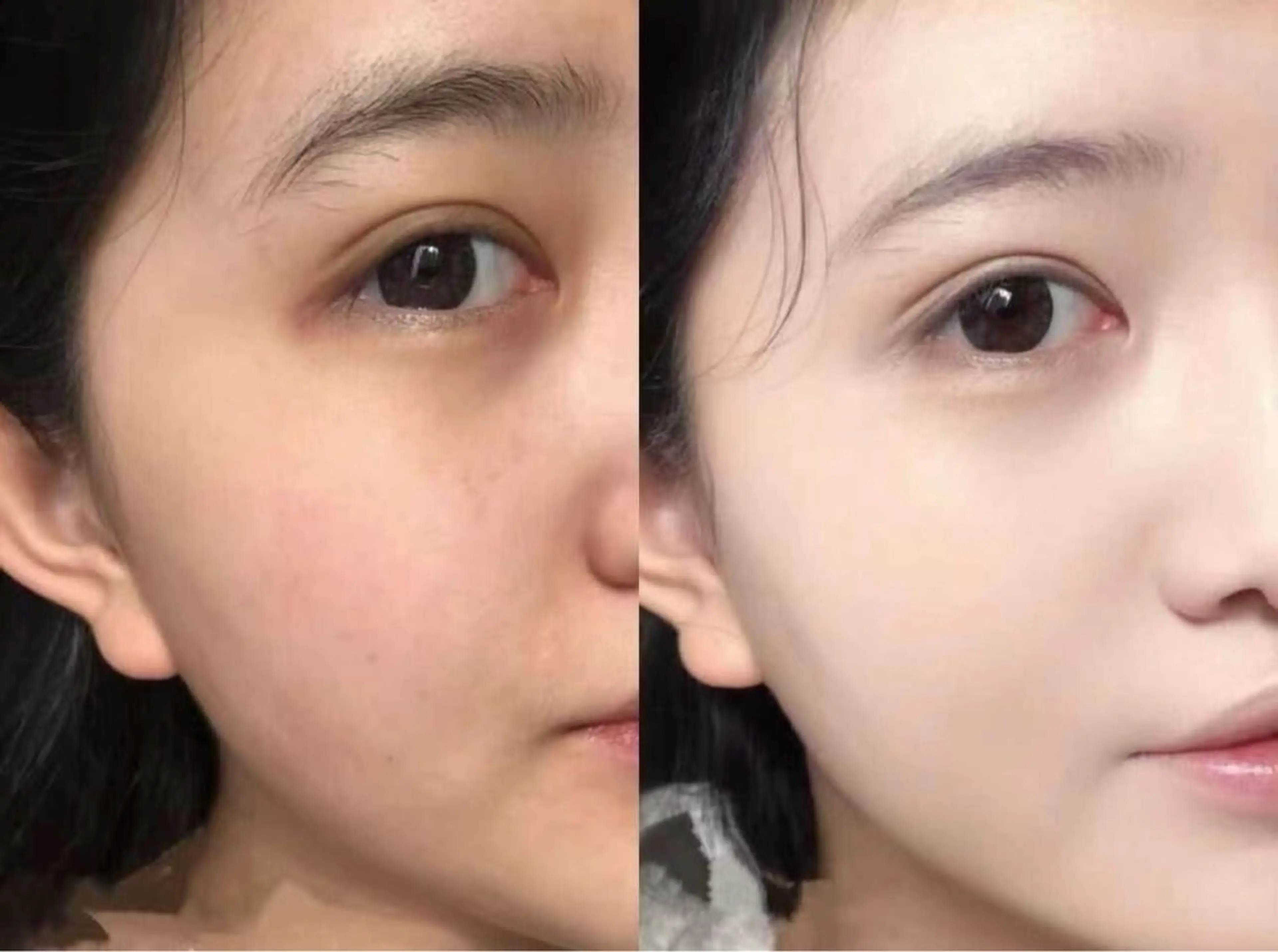 マツエク・マツパ 結婚式・ブライダル エステ aliaハイフ&水光ジェットサロン所属・aliaハーブ水光店 エステティシャン募集のエステ・リラクイメージ