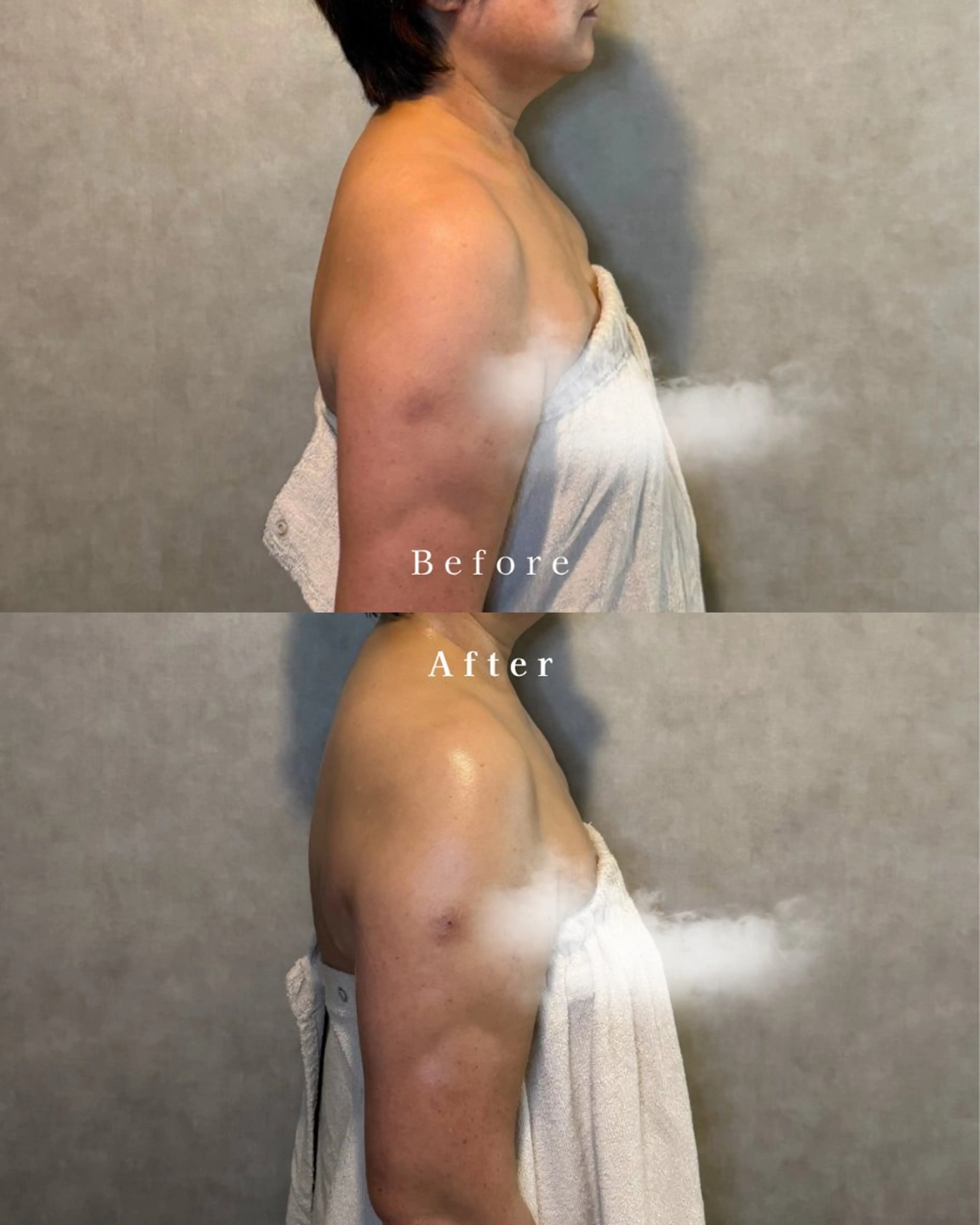 キッズ エステ 肌質改善| Rootree Miのエステ・リラクイメージ