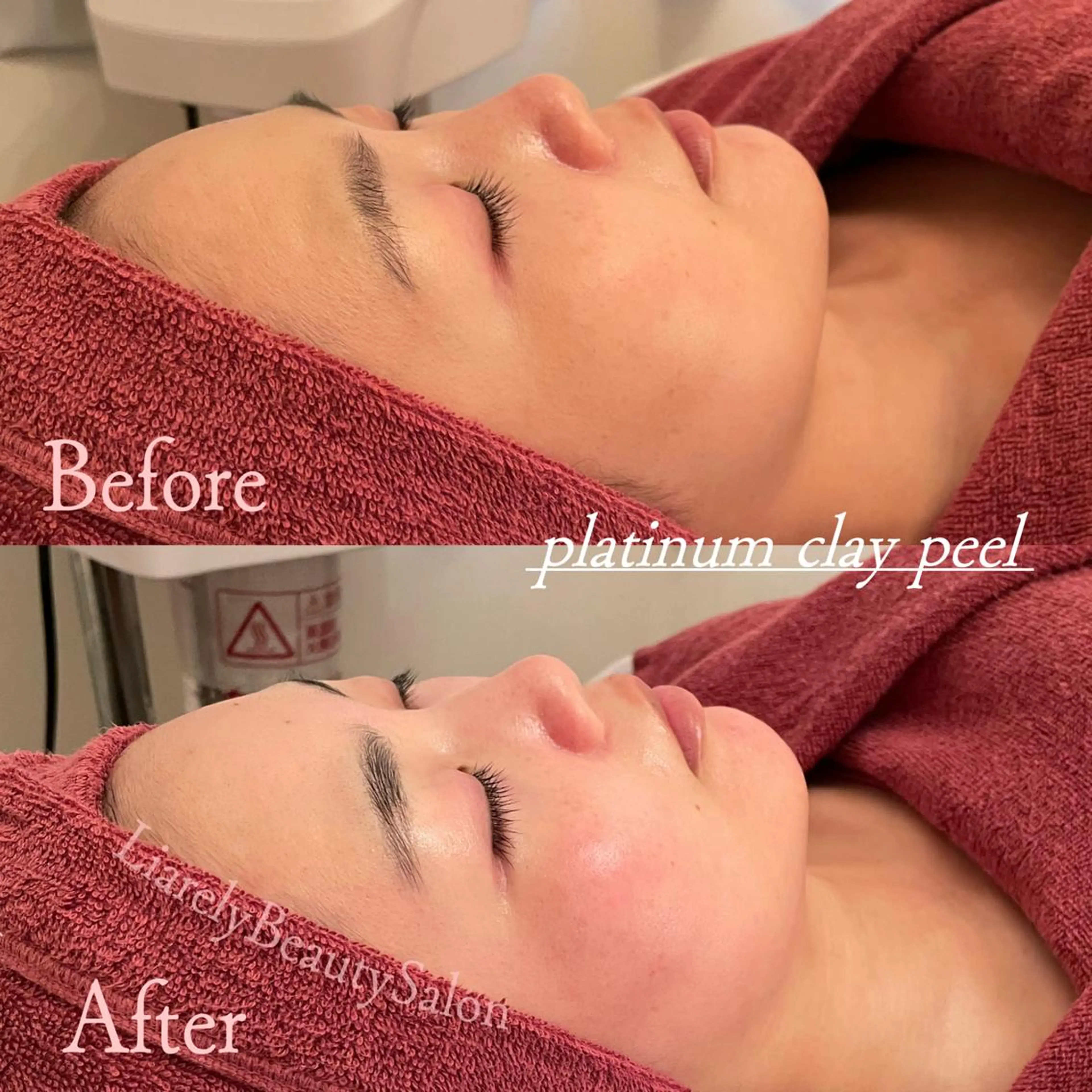 エステ リアレリー 🪞🌹Ryokoのエステ・リラクイメージ