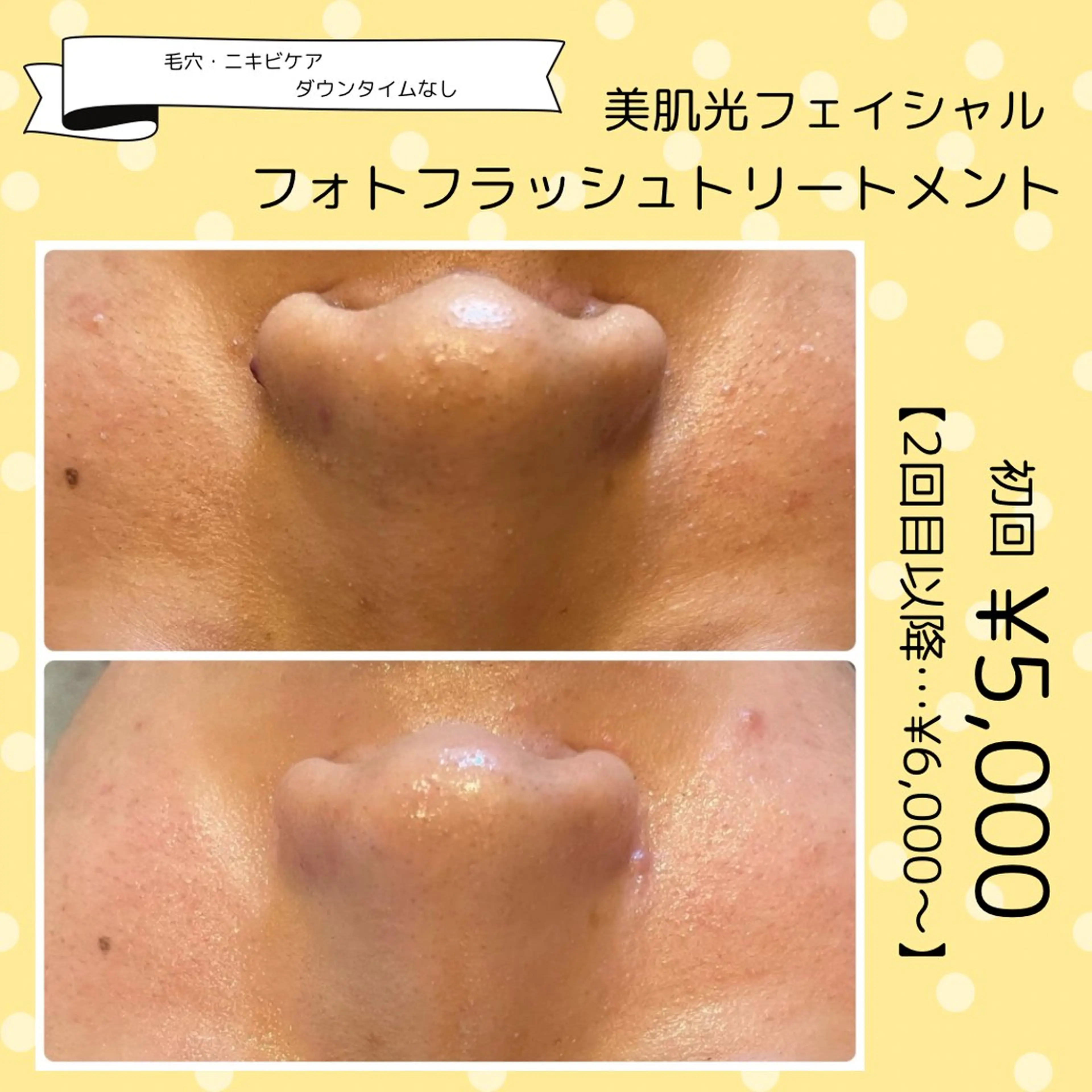 エステ yellow.所属・yellow💛【 脱毛&フェイシャル】のエステ・リラクイメージ