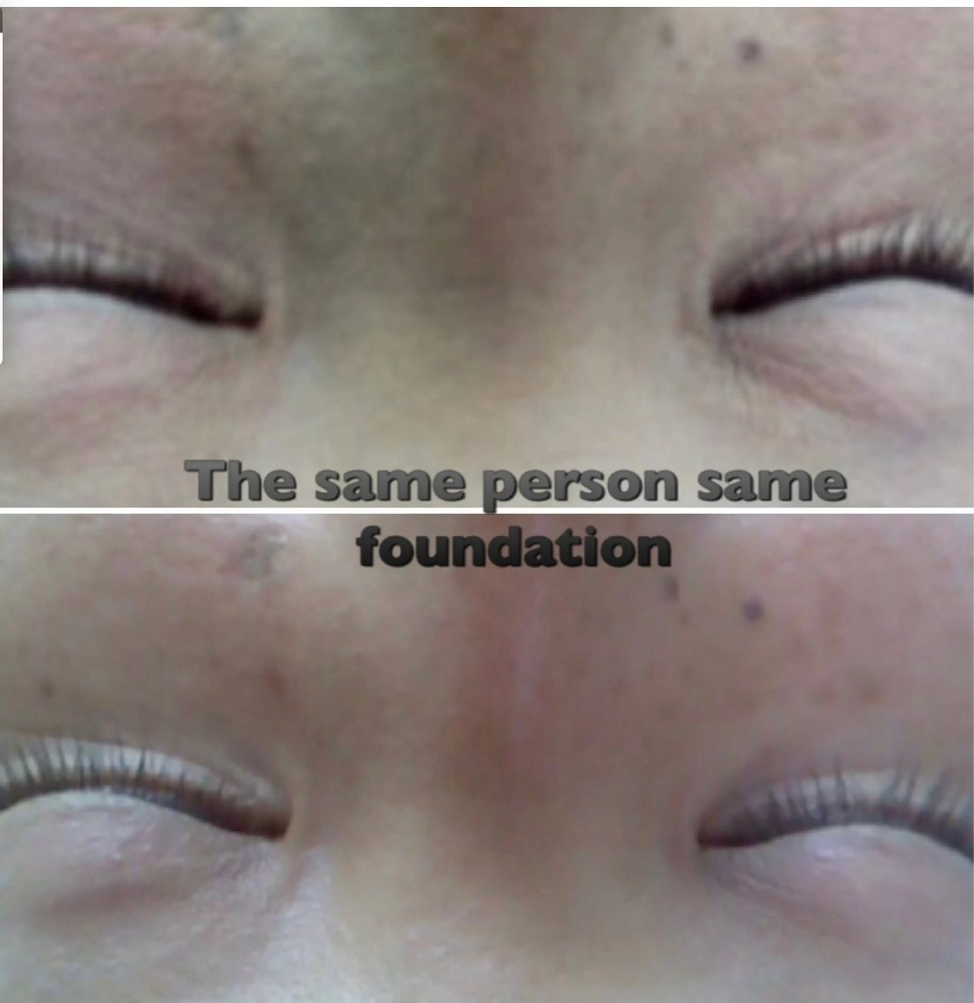 VC、低分子ヒアルロン酸美容液導入の写真