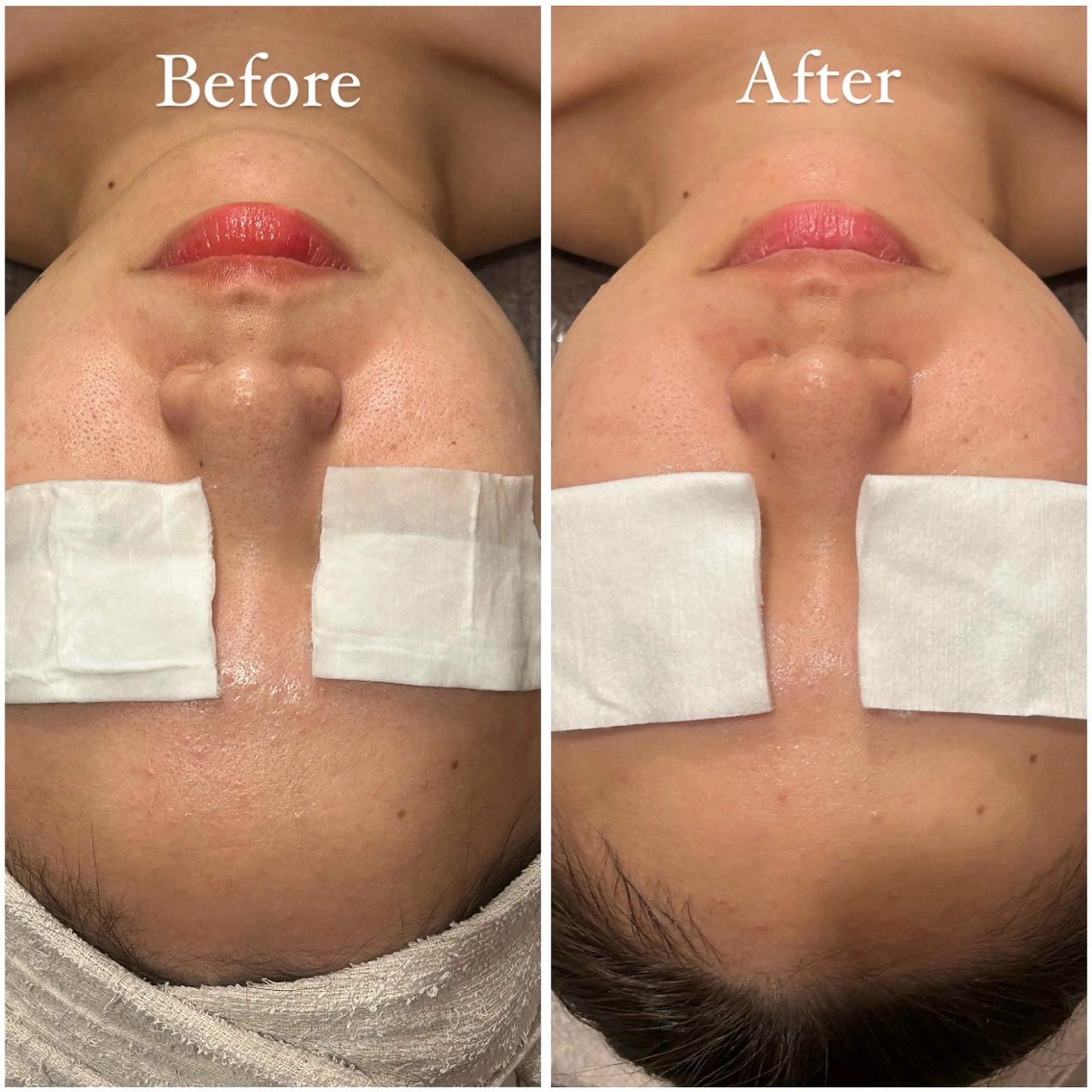 Tulipe Chihoのエステ・リラクイメージ