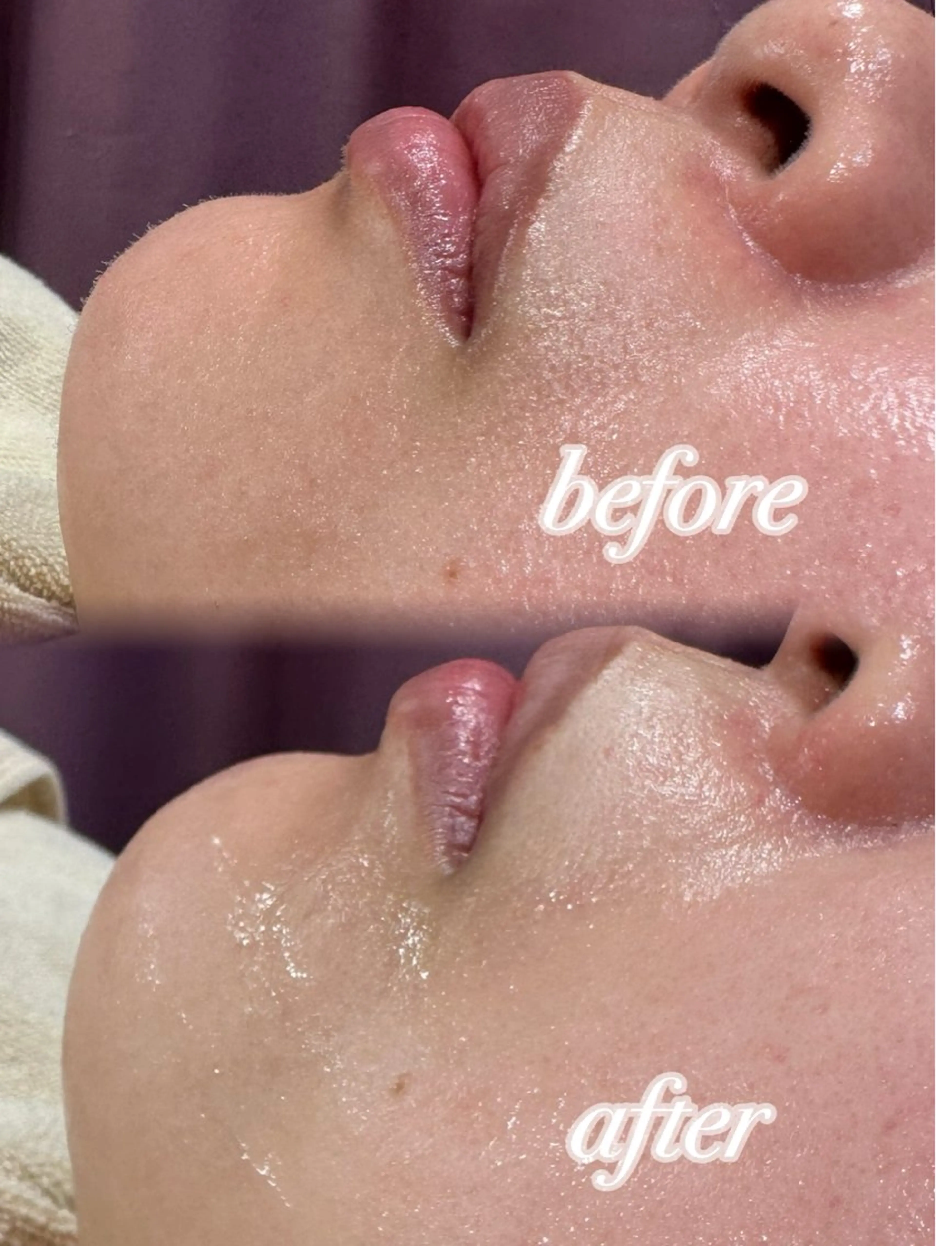 ぷる艶肌🫧 shaving斉藤のその他イメージ