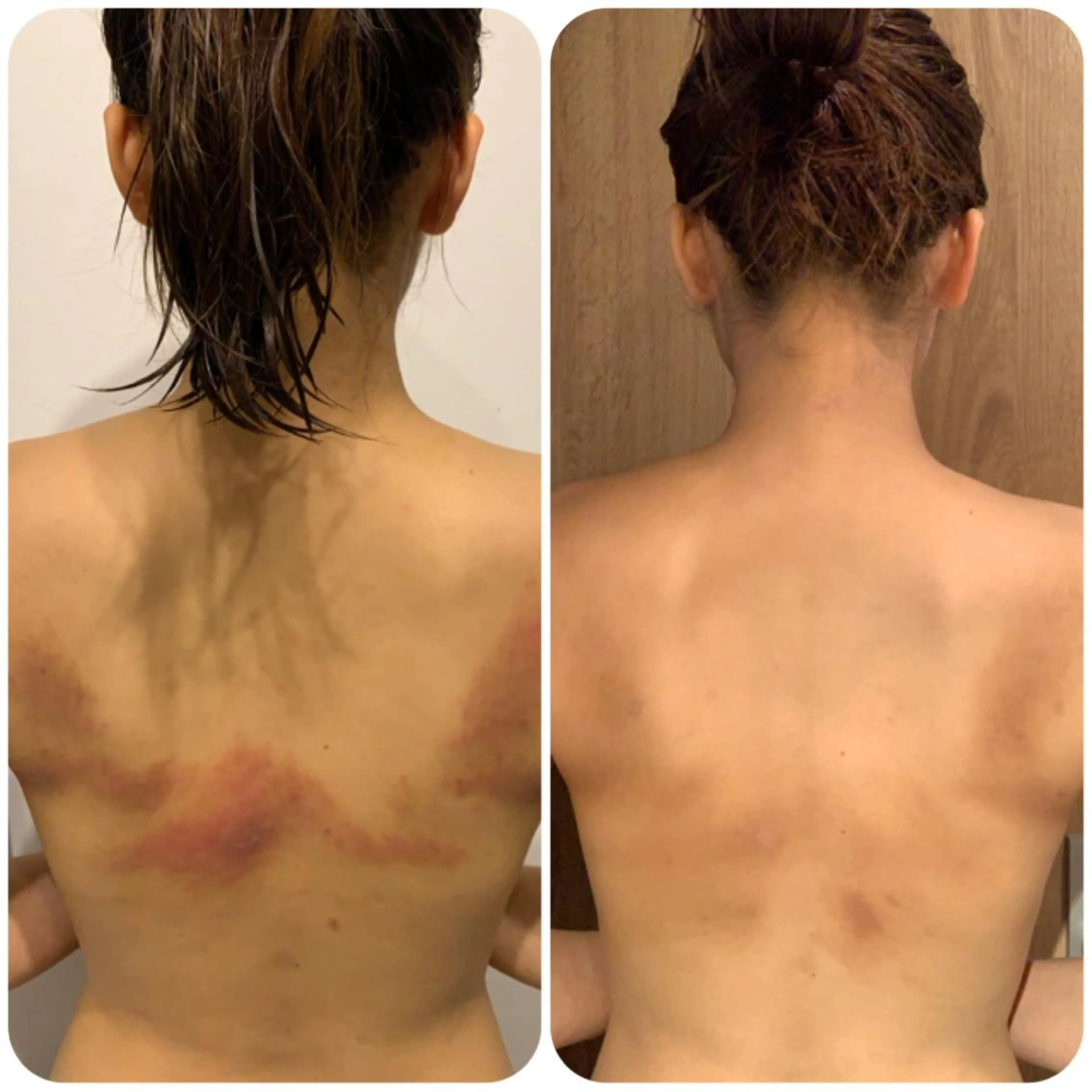 エステ DeCoLé Beauty所属・艶肌/敏感肌/若さ/ ボディ痩身🌿のエステ・リラクイメージ