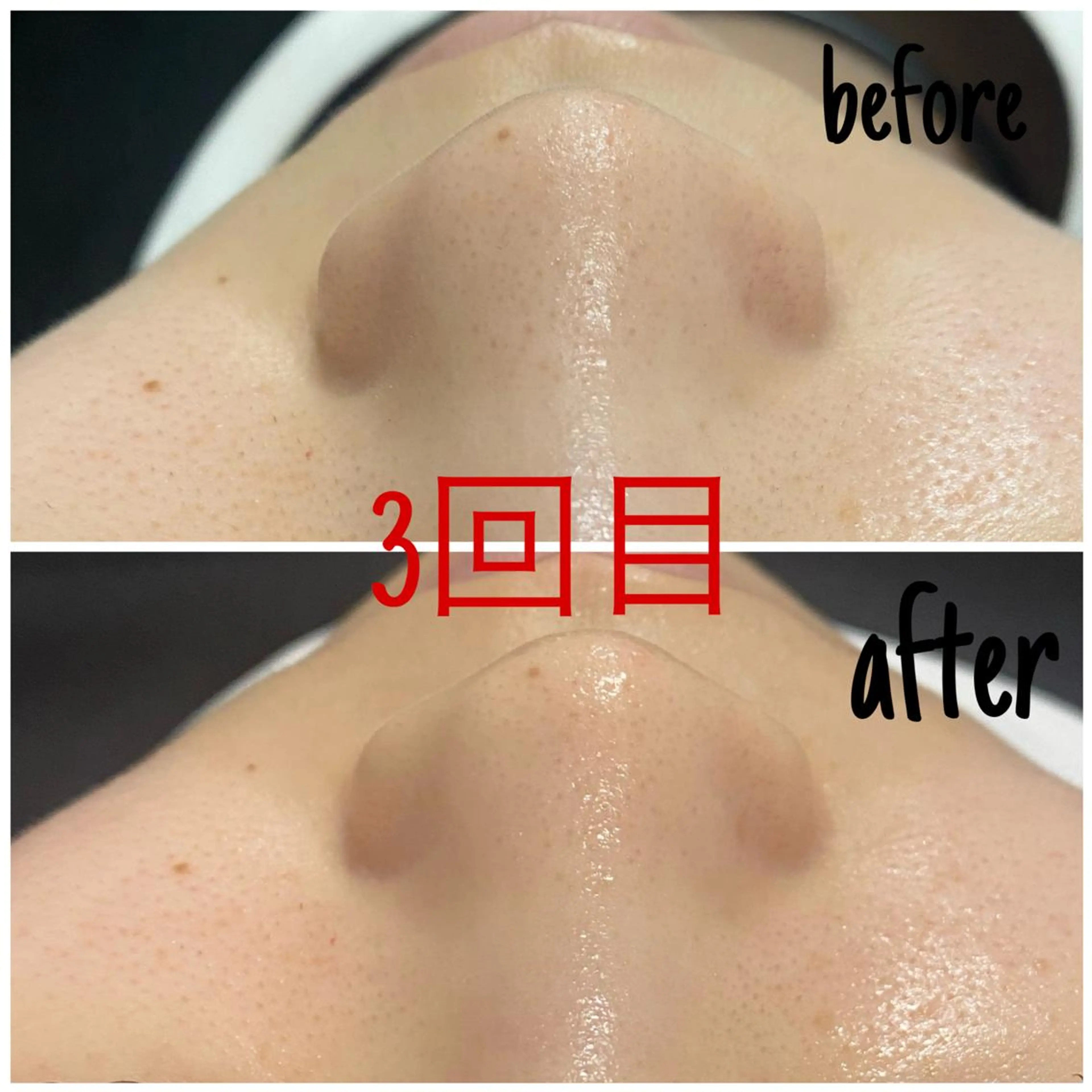 エステ 毛穴洗浄・痩身・脱毛 /アルカンジュのエステ・リラクイメージ