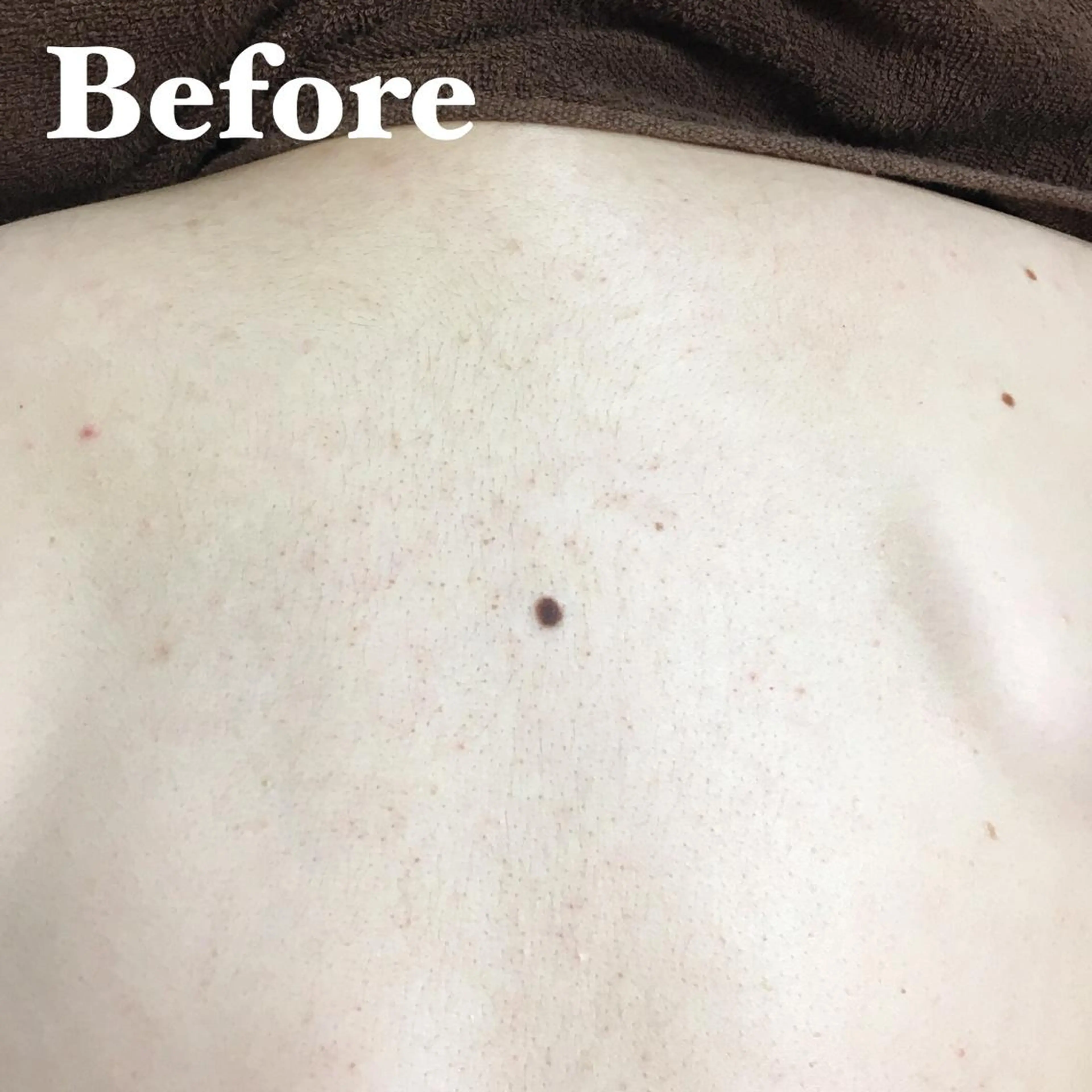 MIMI 吉祥寺2号店のエステ・リラクイメージ