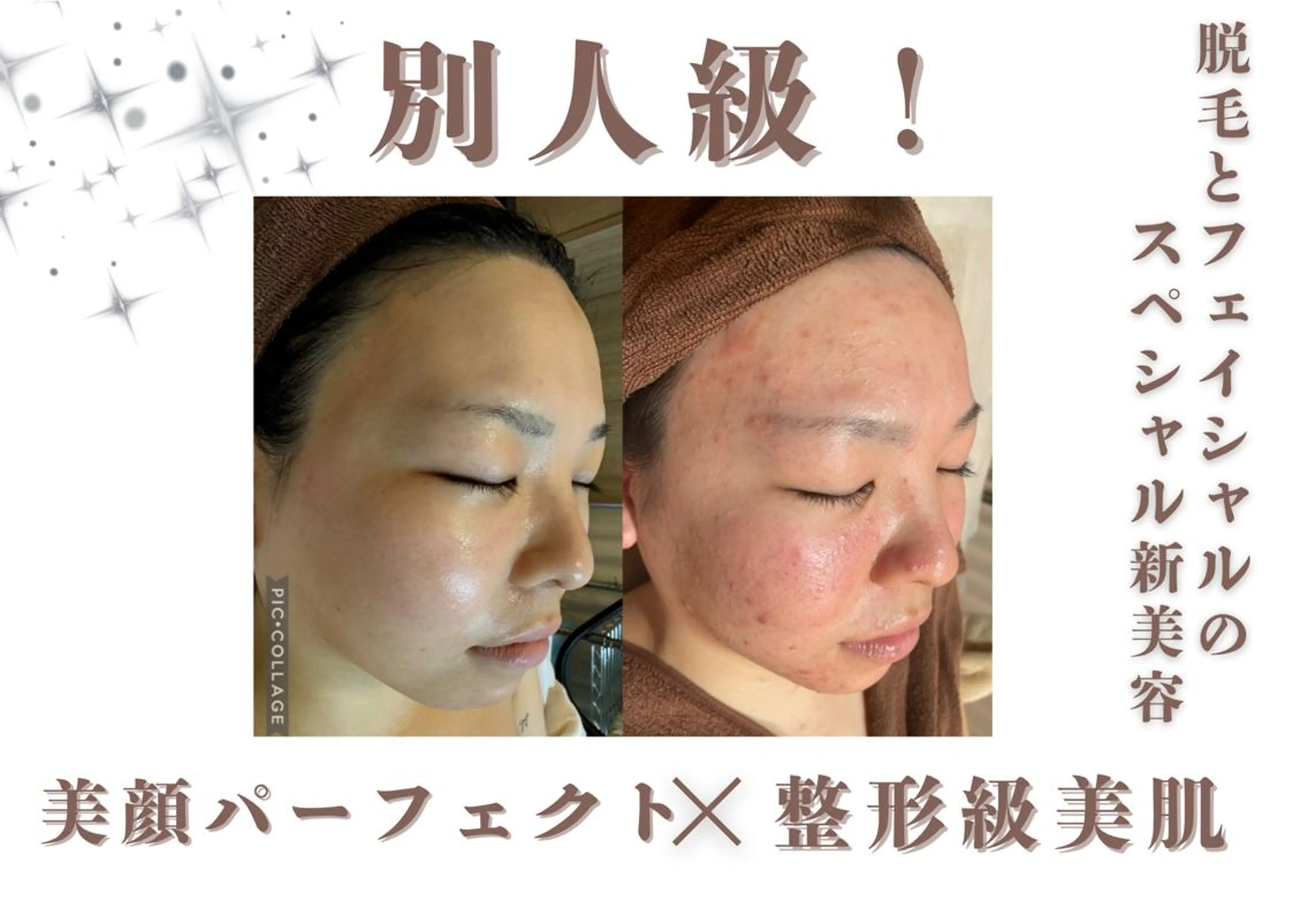 脱毛 創業40周年✨美肌サ ロンRAYVIS銀座のエステ・リラクイメージ