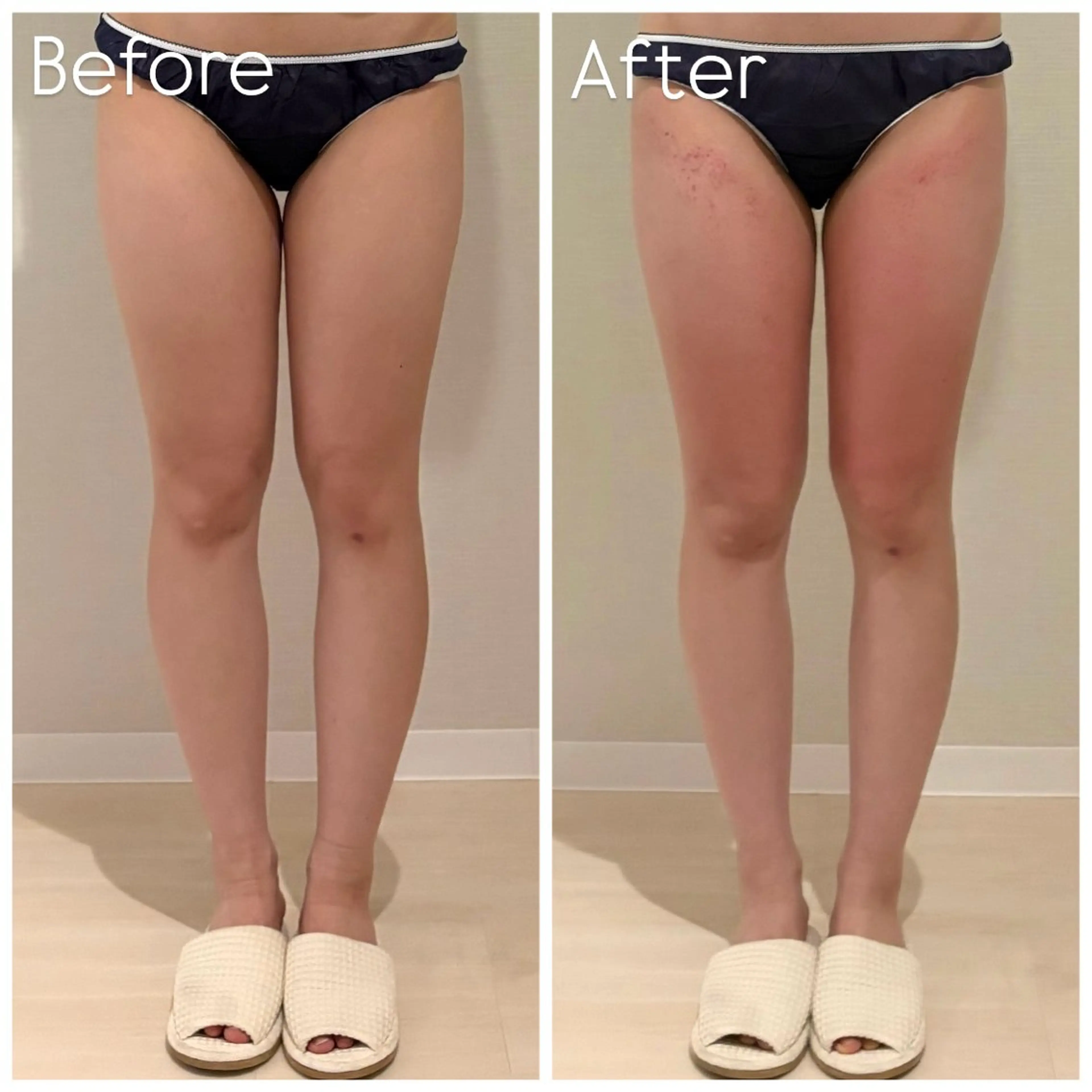 Lib Charm 北本結愛のエステ・リラクイメージ