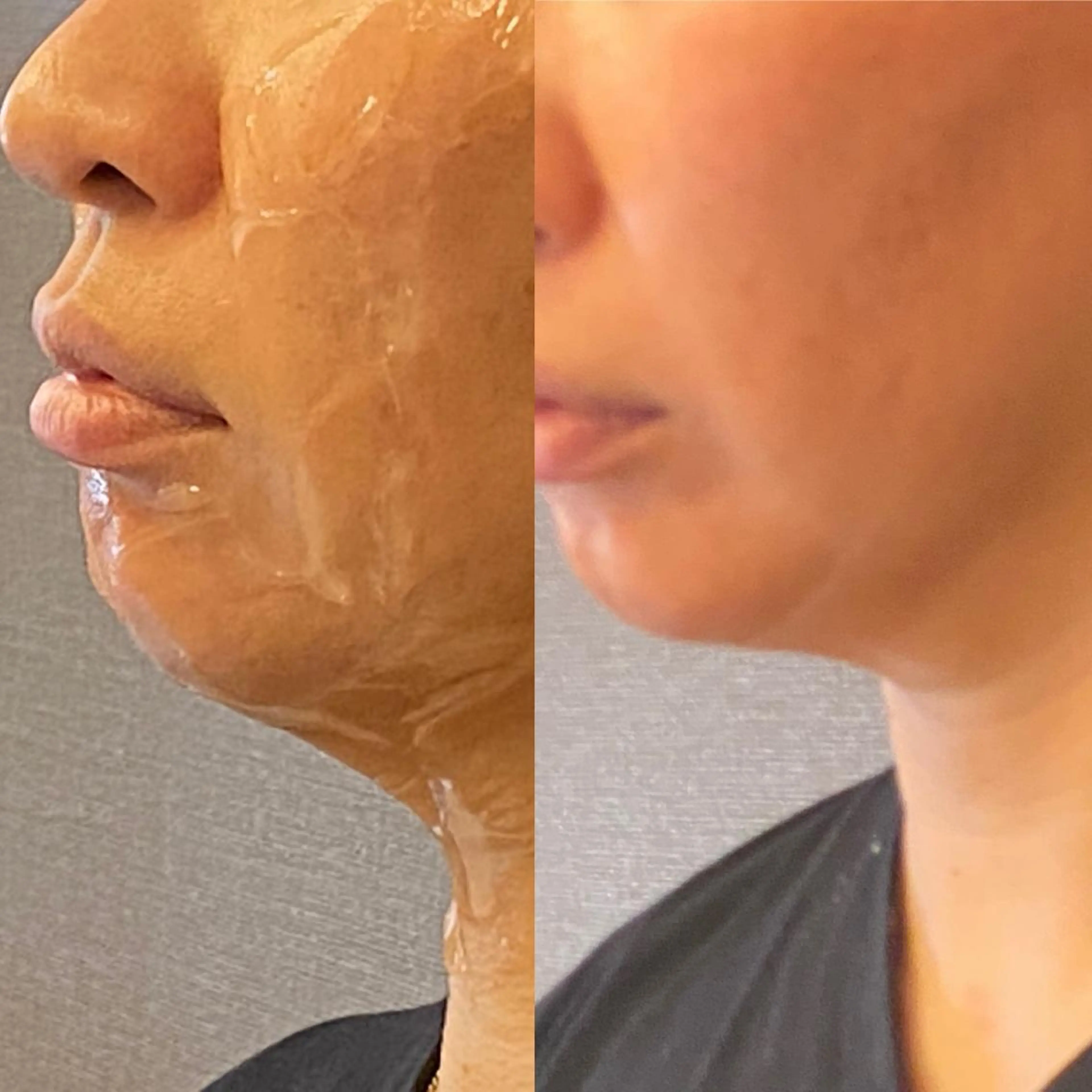 エステ トータルビューティー マウロアのエステ・リラクイメージ