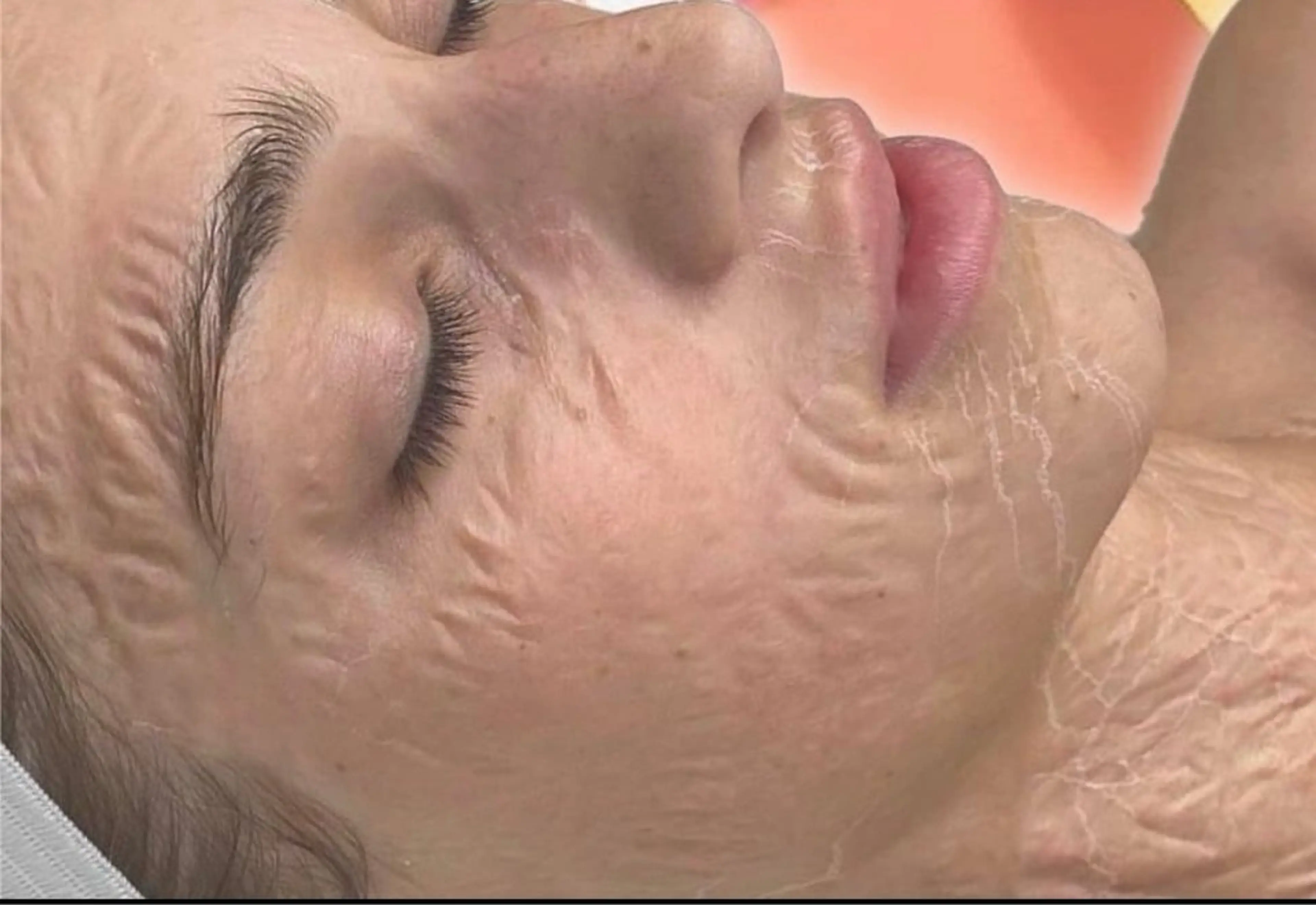 まるで塗るボトッ○ス！？集中エイジングケア　毛穴引き締めゾンビマスク　シワ、くすみにもの写真