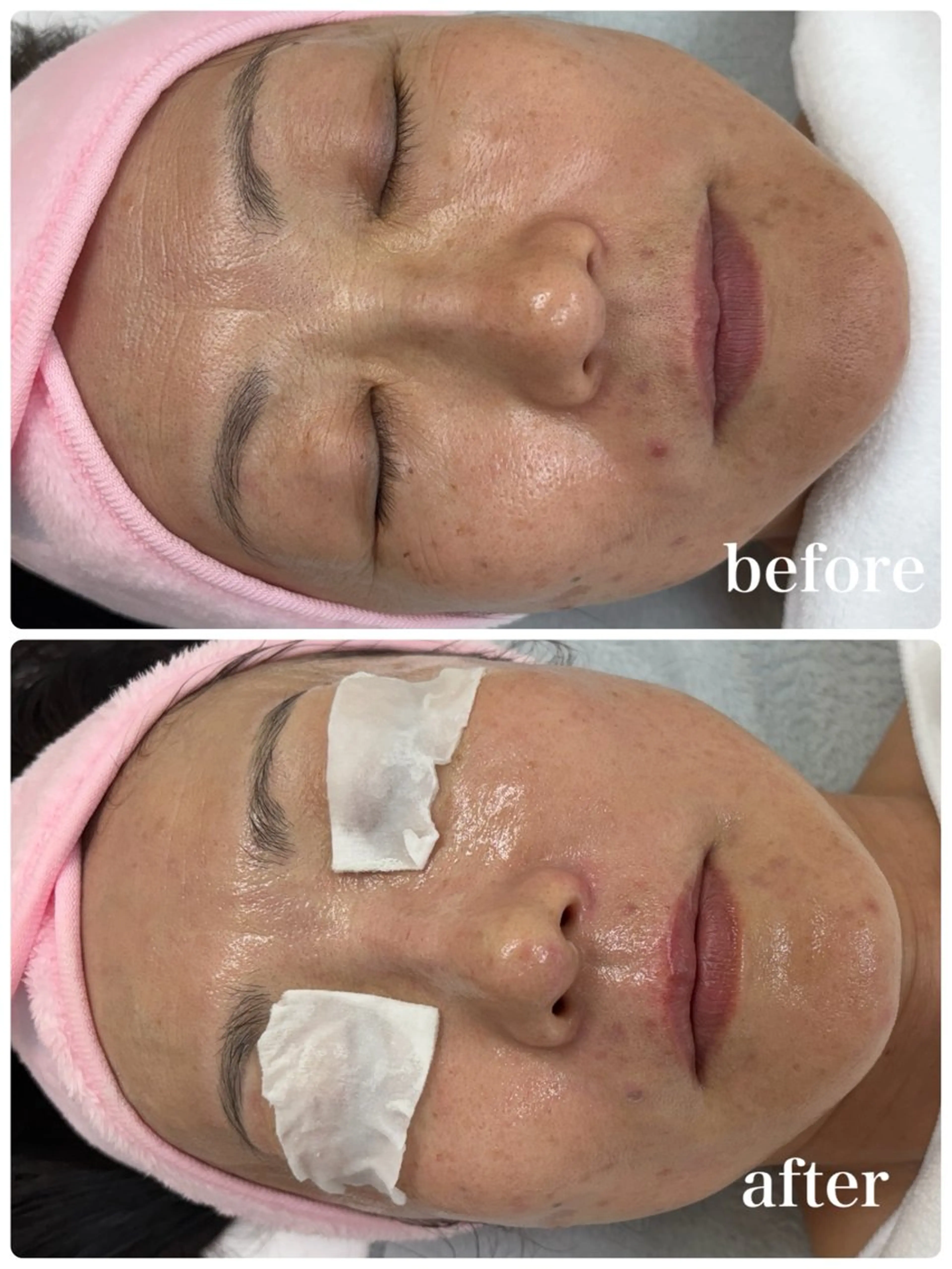 エステ フェイシャルサロン クリスタのエステ・リラクイメージ