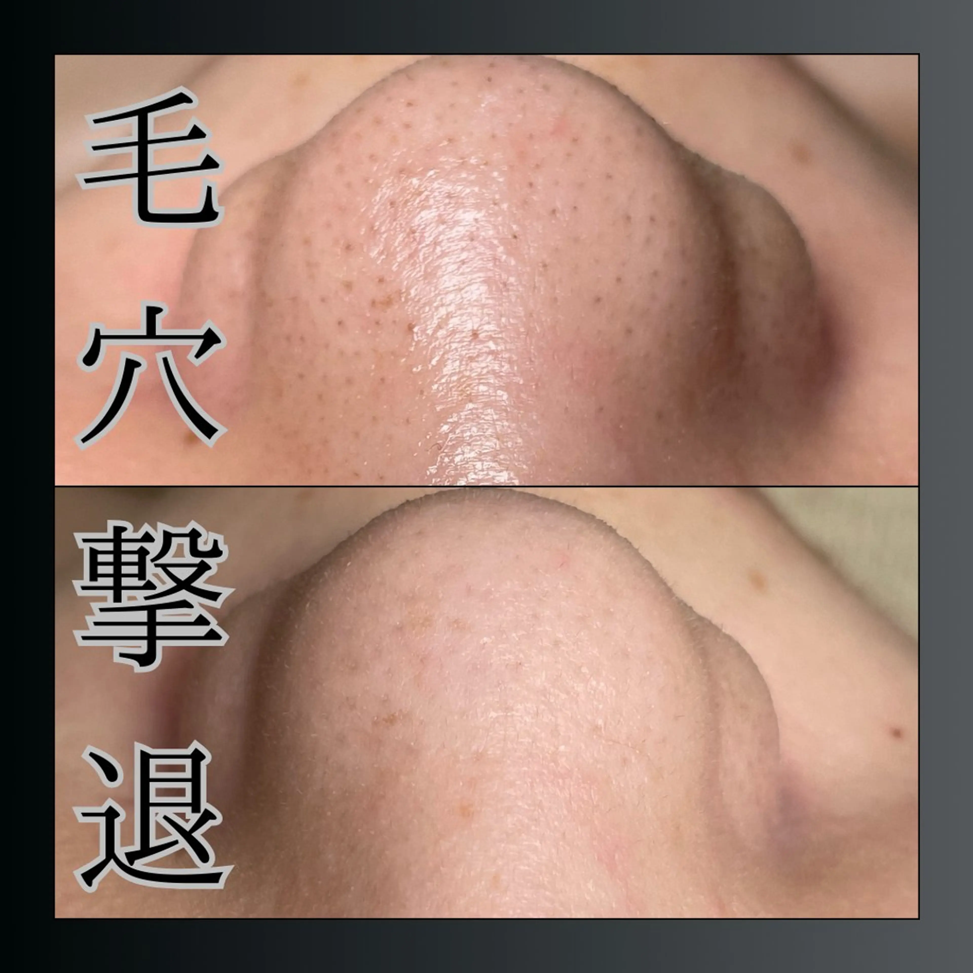 LiZA エステティックサロンのエステ・リラクイメージ