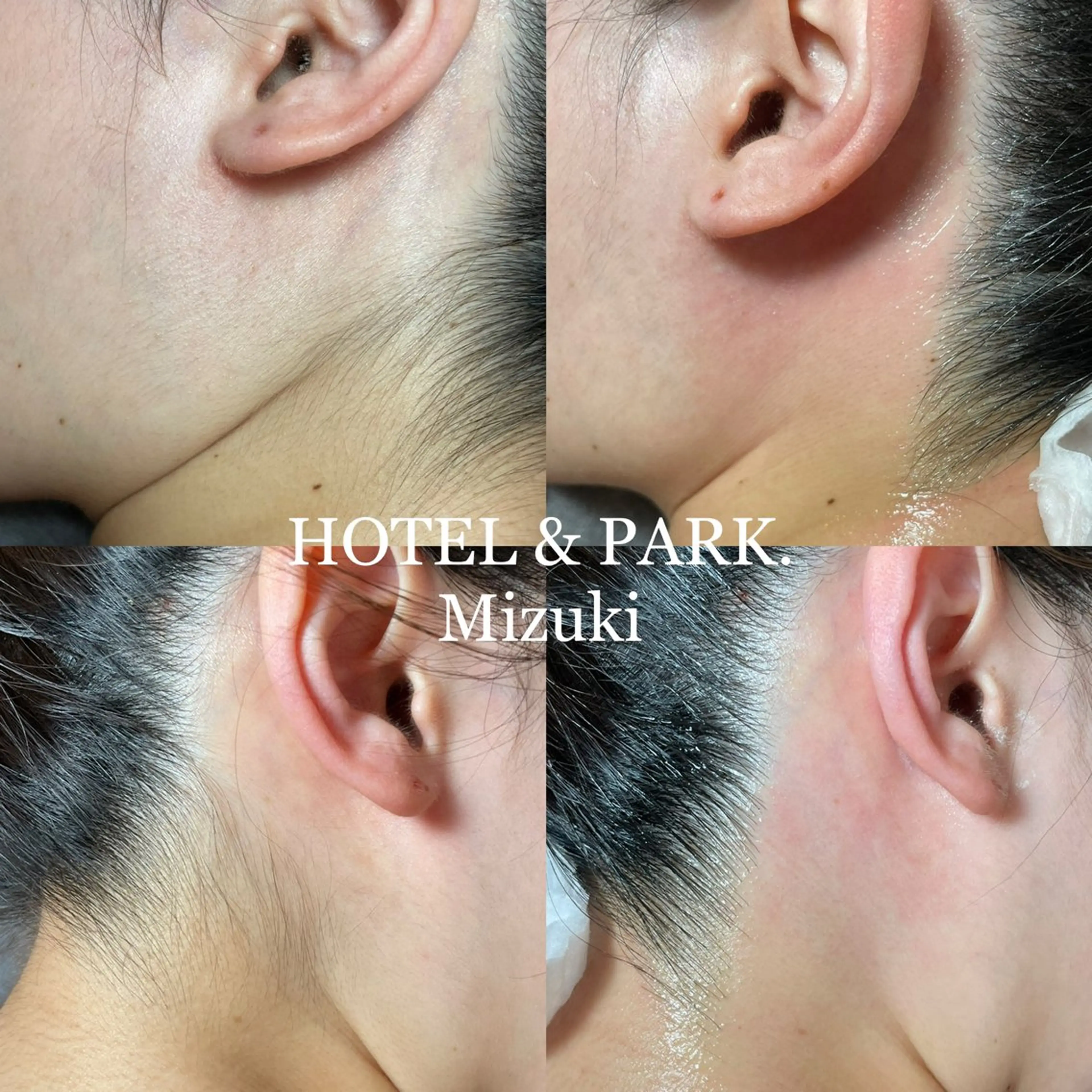 HOTEL&PARK . ワックス脱毛のエステ・リラクイメージ